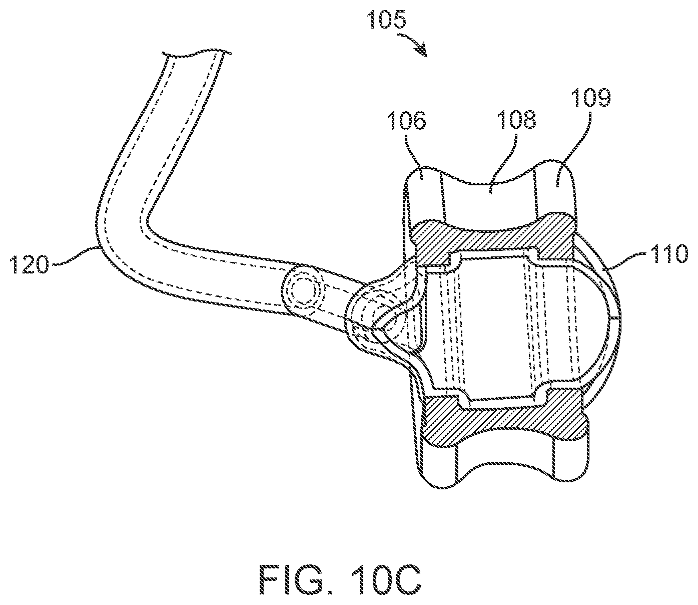 Patent US12102785 Figure 13 – Inner ear drug delivery devices and methods of use