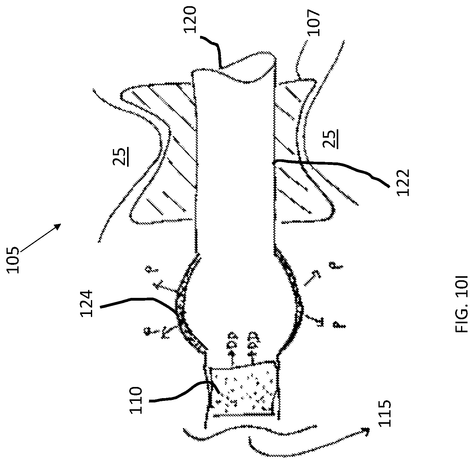 Patent US12102785 Figure 16 – Inner ear drug delivery devices and methods of use