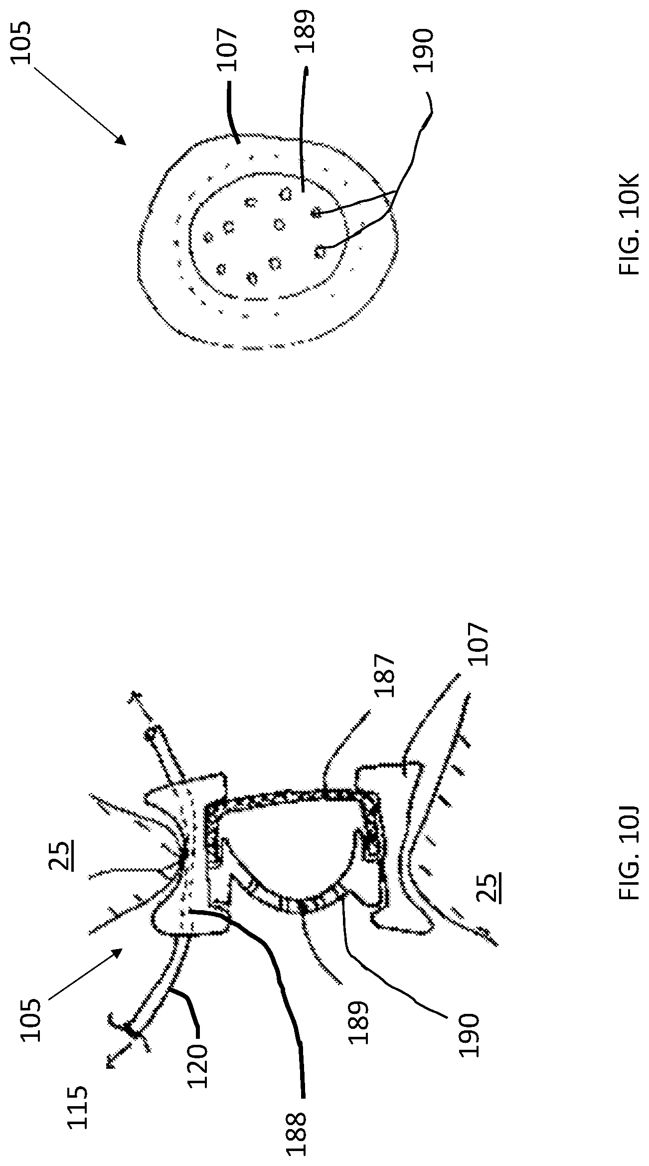 Patent US12102785 Figure 17 – Inner ear drug delivery devices and methods of use