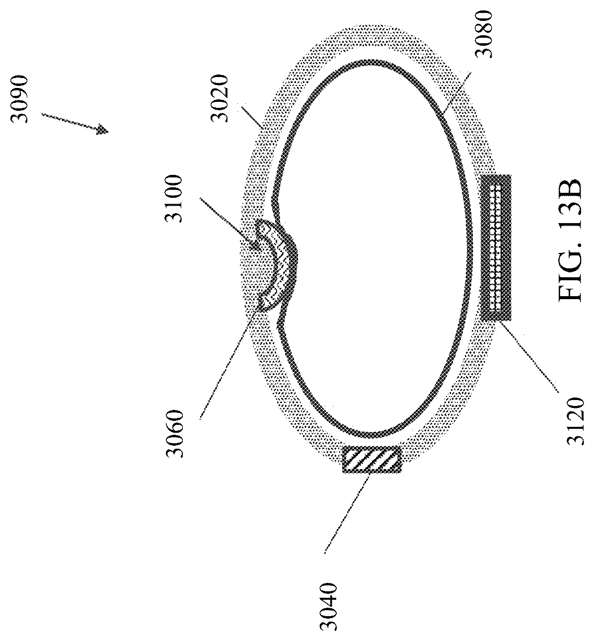 Patent US12102790 Figure 17 – Connected drug delivery system for erythropoietin stimulating agents