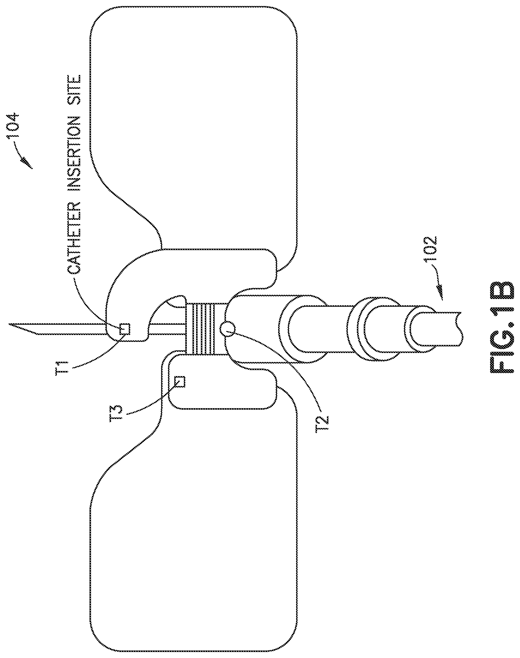 Patent US12102794 Figure 2 – Catheter dressing and/or securement device and system, method, and product for intravenous site condition detection