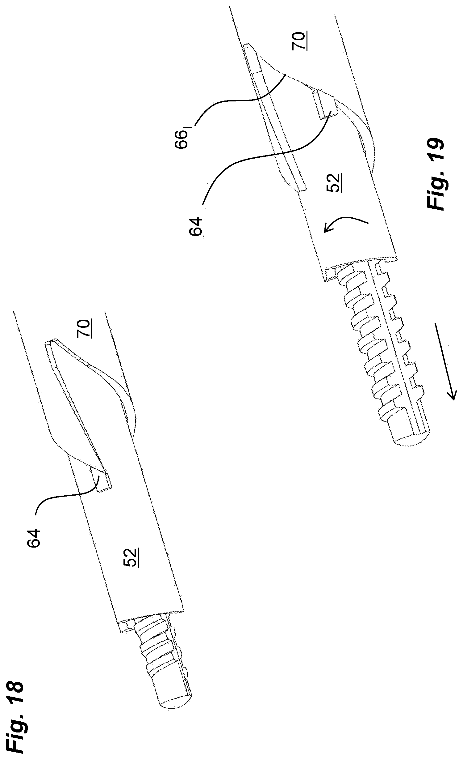 Patent US12102806 Figure 15 – Actuation mechanism