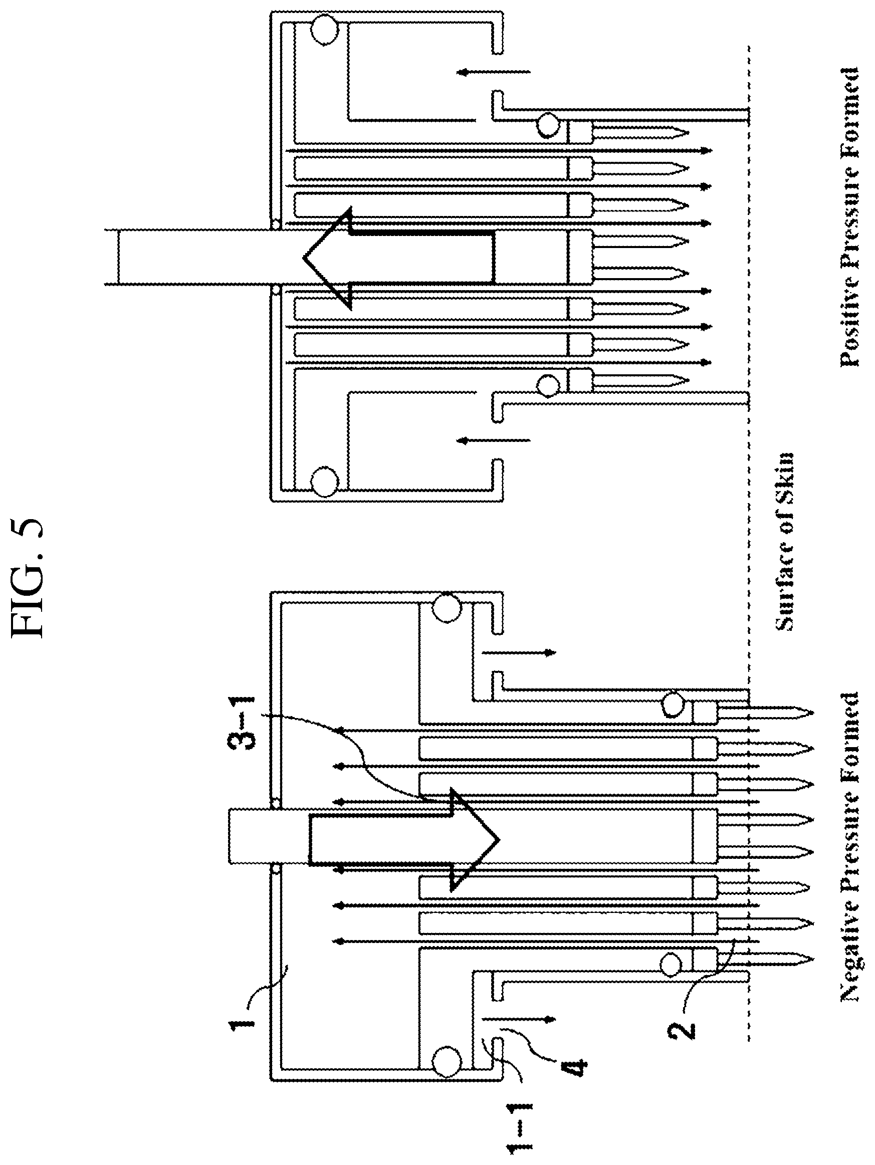 Patent US12102811 Figure 5 – Medicine injecting tip, hand piece, and skin treating device