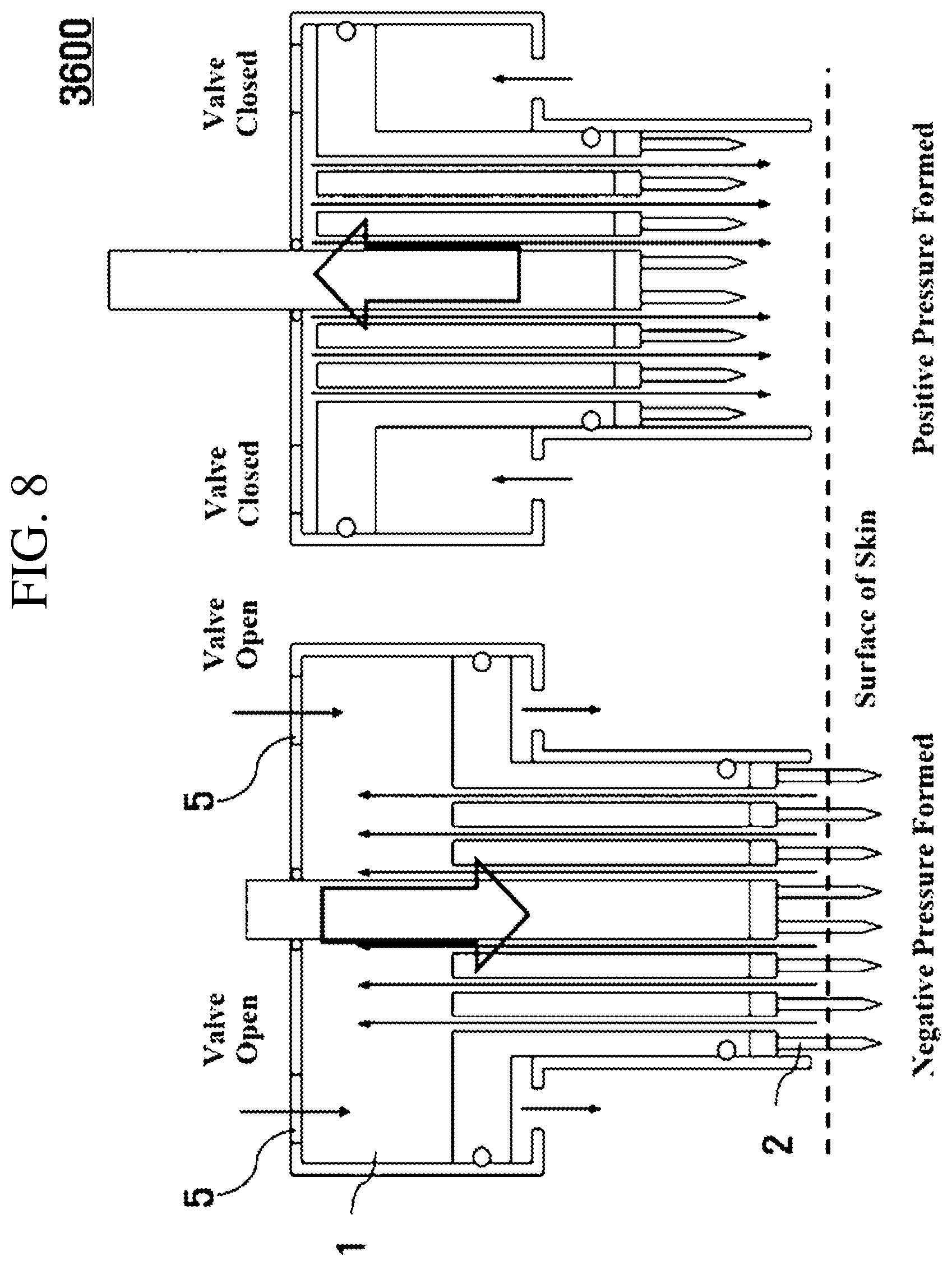 Patent US12102811 Figure 8 – Medicine injecting tip, hand piece, and skin treating device