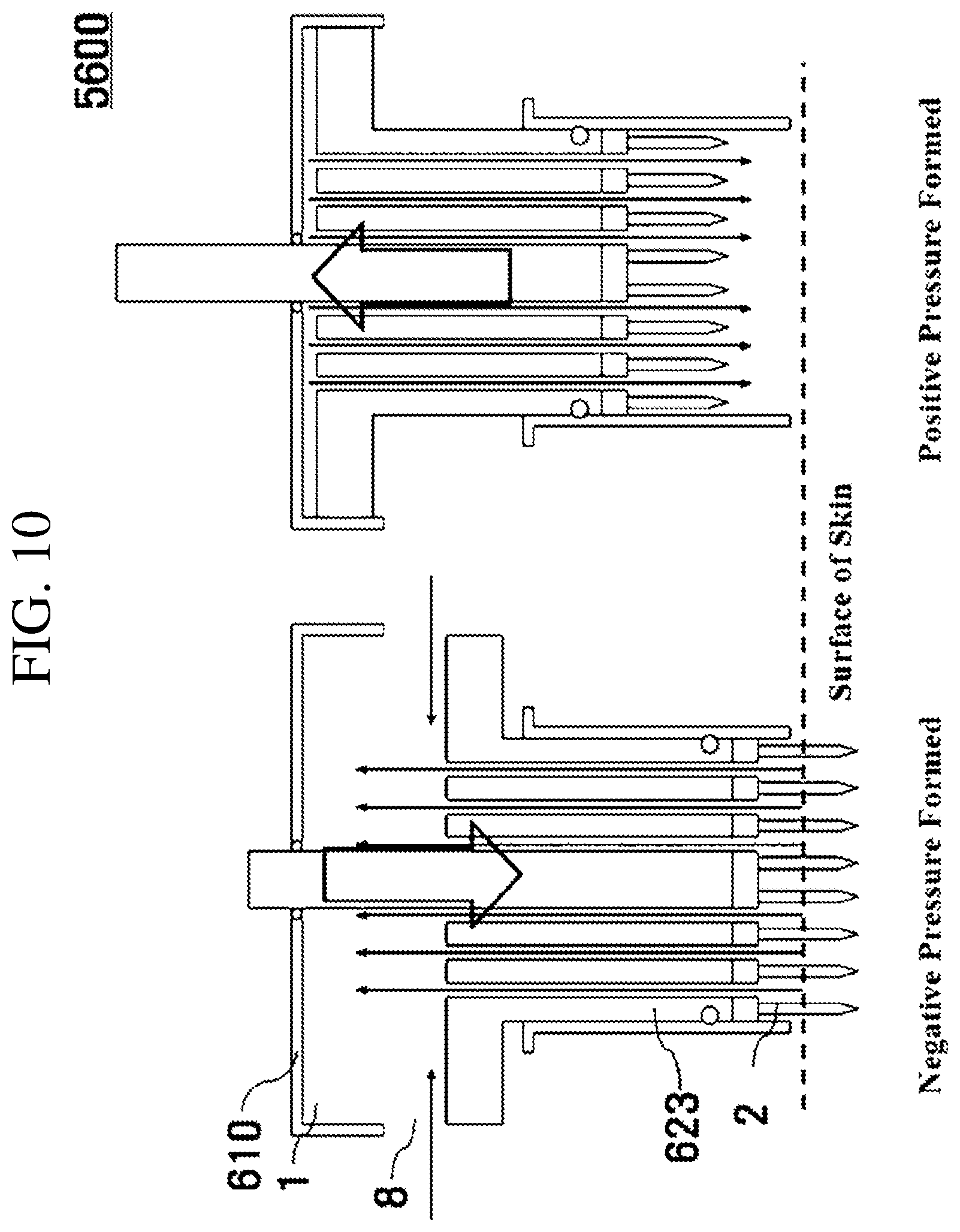 Patent US12102811 Figure 10 – Medicine injecting tip, hand piece, and skin treating device