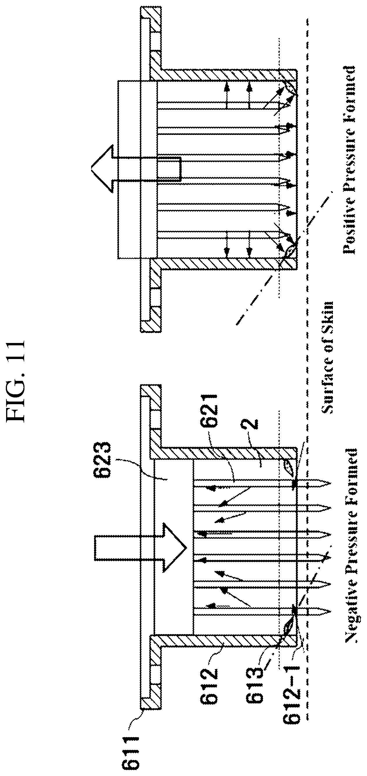 Patent US12102811 Figure 11 – Medicine injecting tip, hand piece, and skin treating device