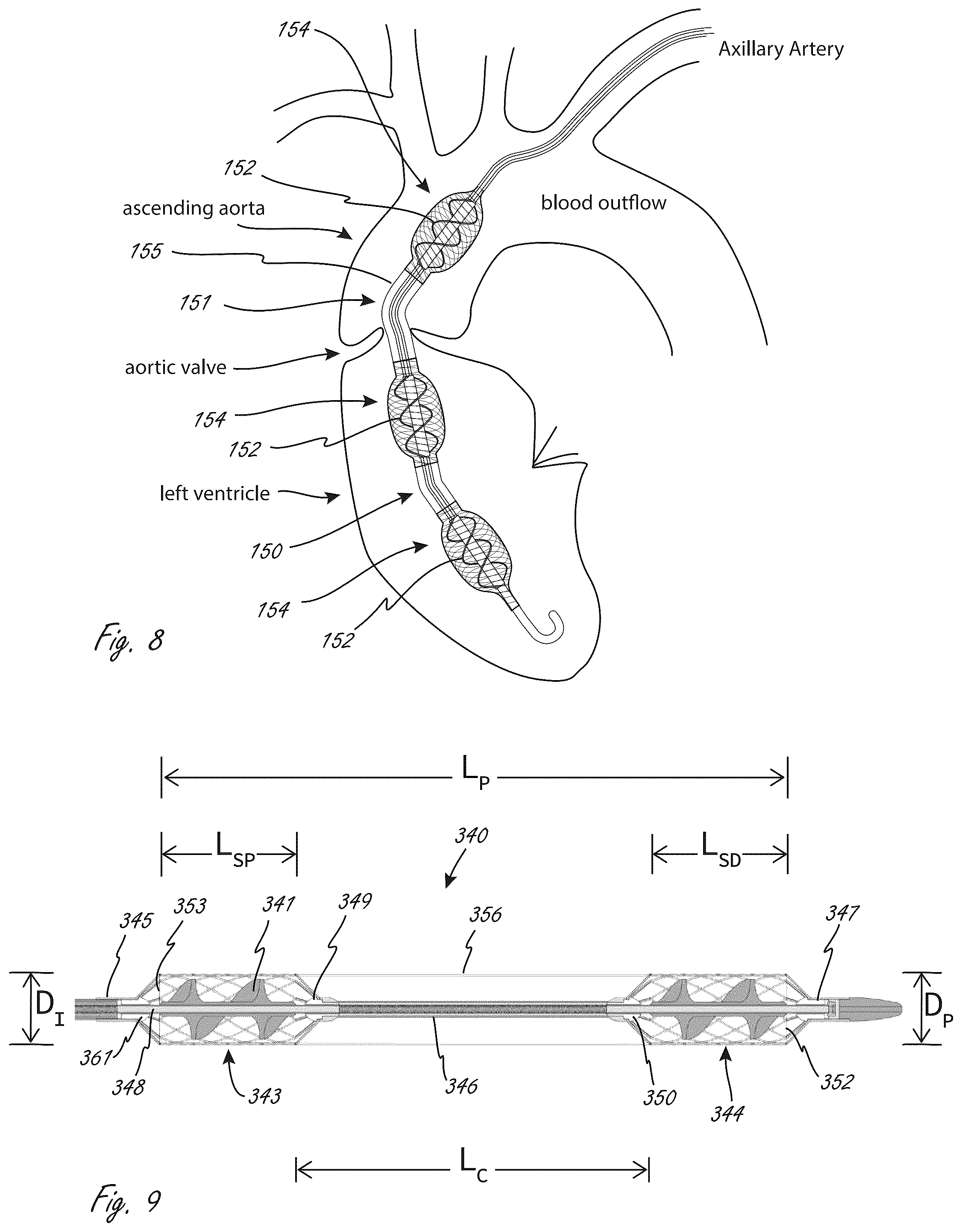 Patent US12102815 Figure 7 – Catheter blood pumps and collapsible pump housings