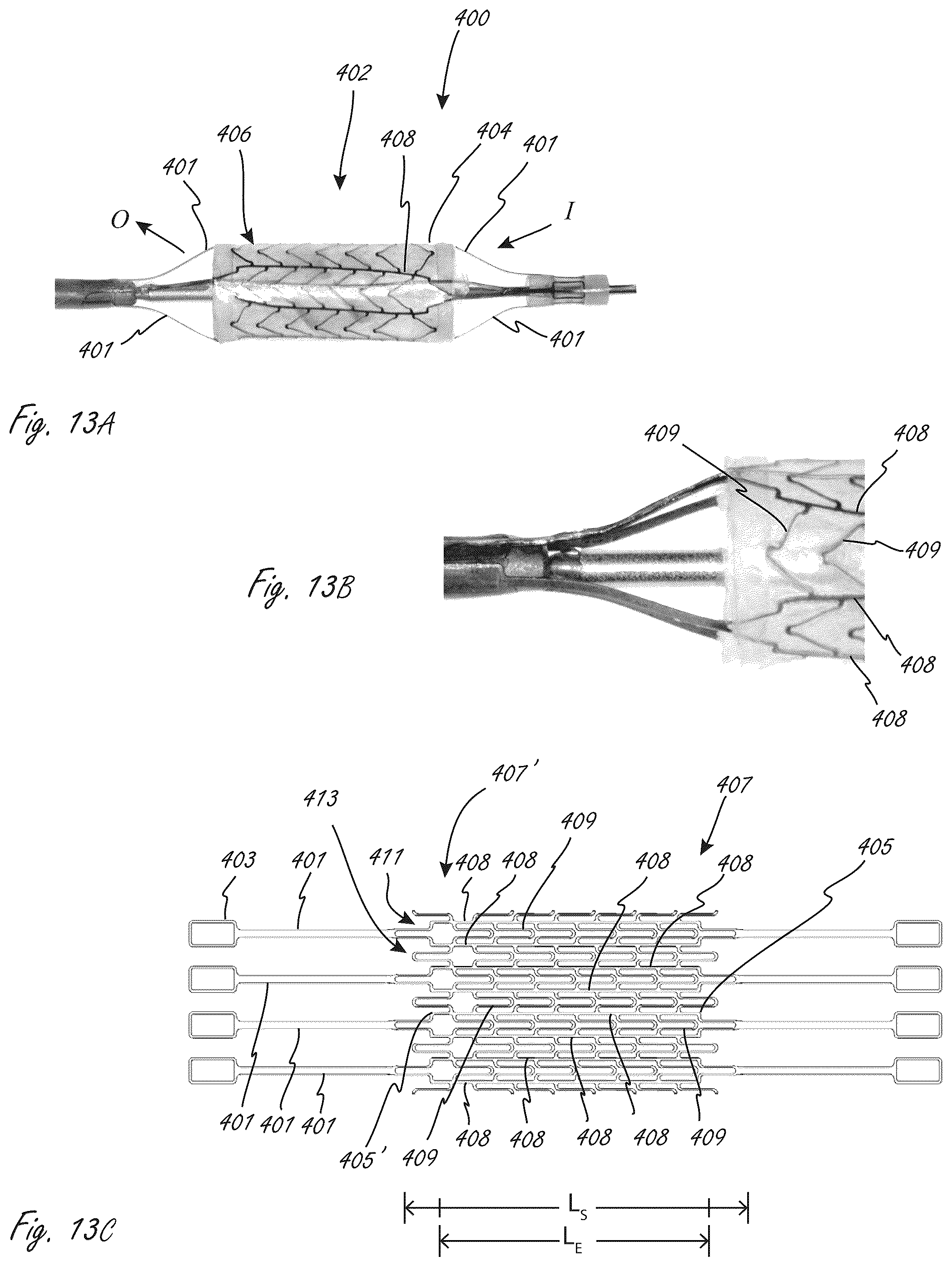 Patent US12102815 Figure 15 – Catheter blood pumps and collapsible pump housings