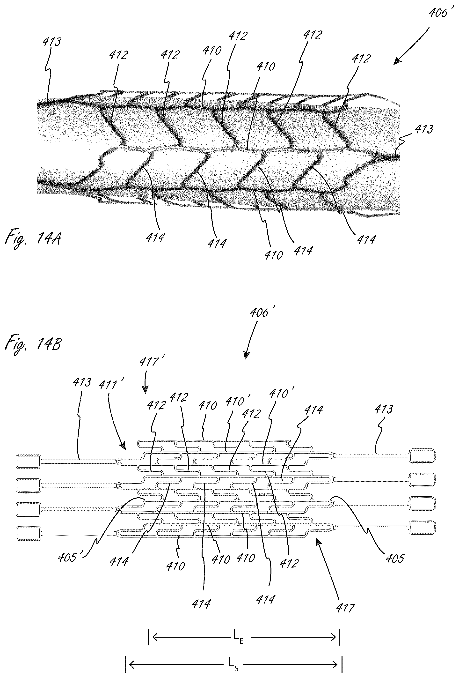 Patent US12102815 Figure 16 – Catheter blood pumps and collapsible pump housings