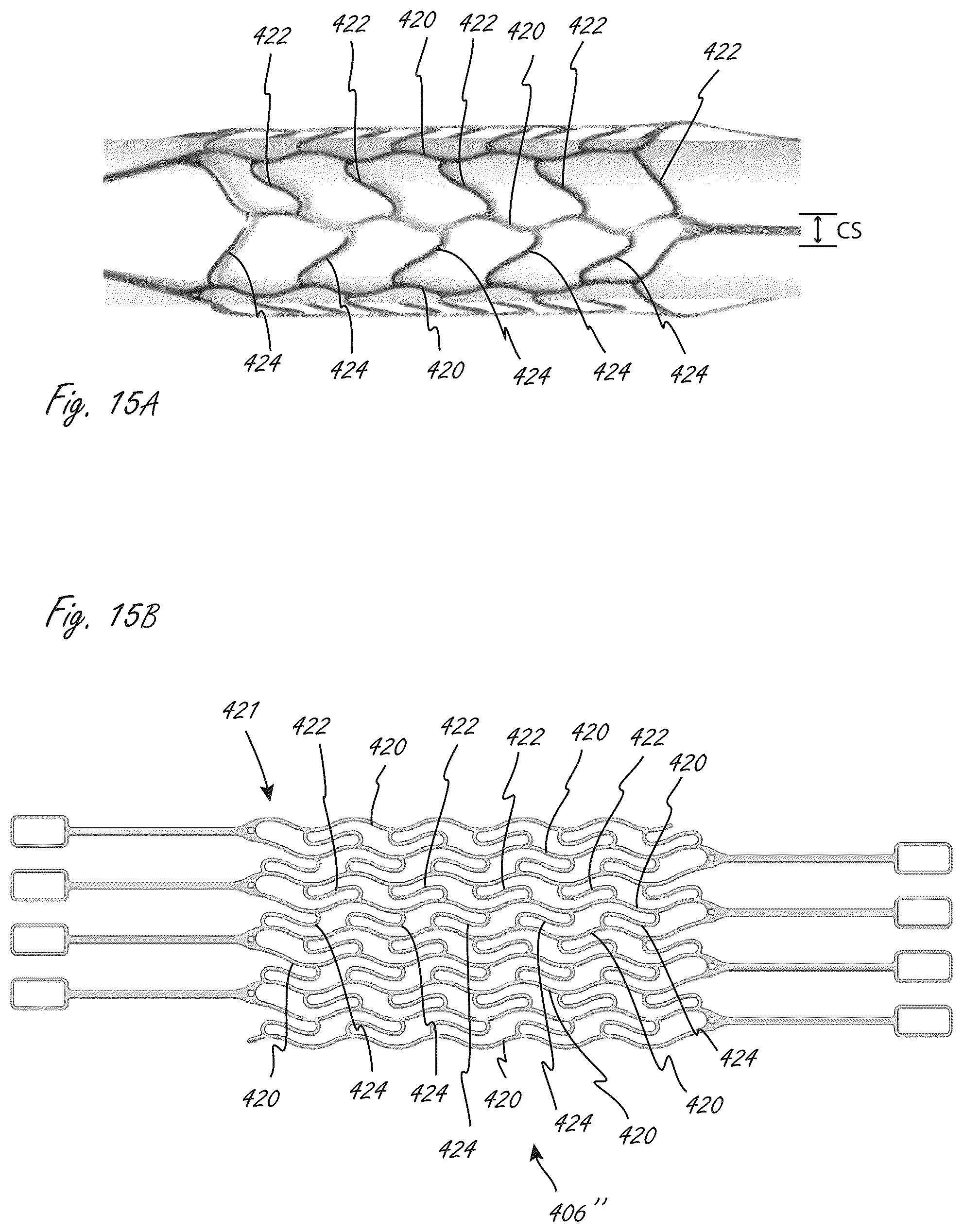 Patent US12102815 Figure 17 – Catheter blood pumps and collapsible pump housings