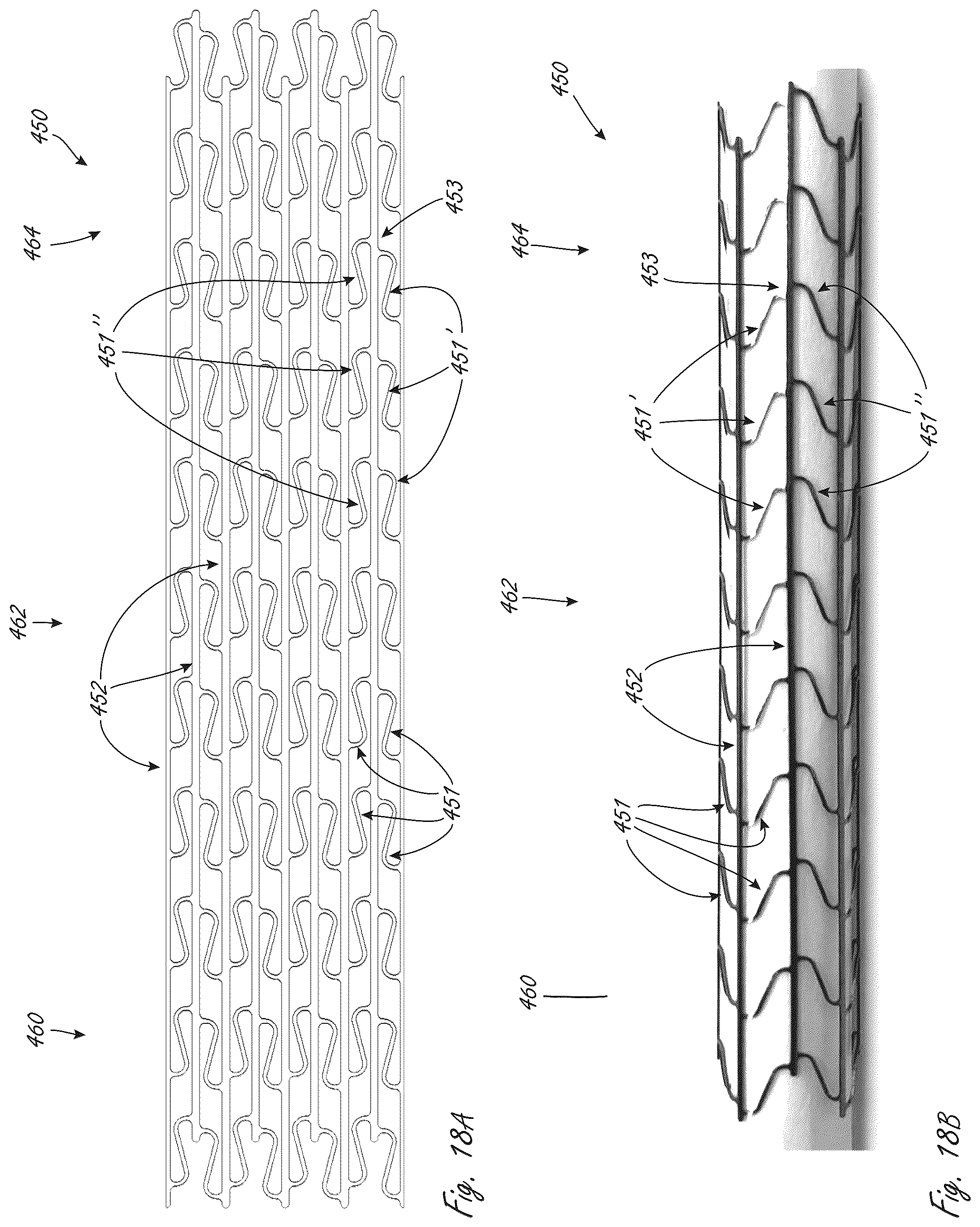 Patent US12102815 Figure 19 – Catheter blood pumps and collapsible pump housings