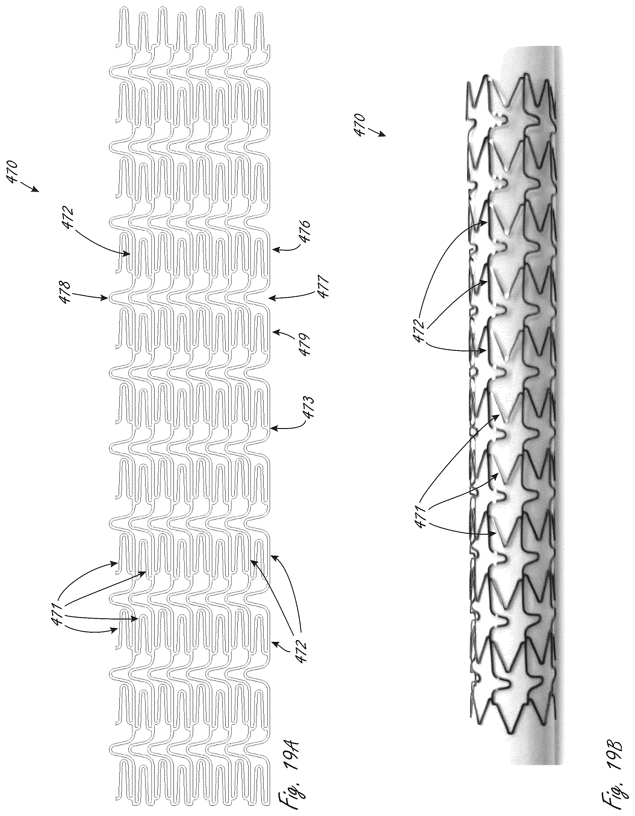 Patent US12102815 Figure 20 – Catheter blood pumps and collapsible pump housings