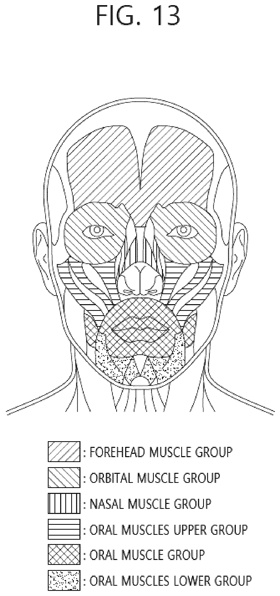 Patent US12102819 Figure 16 – Electrical muscle stimulation method using the electrical muscle simulation electrode pad