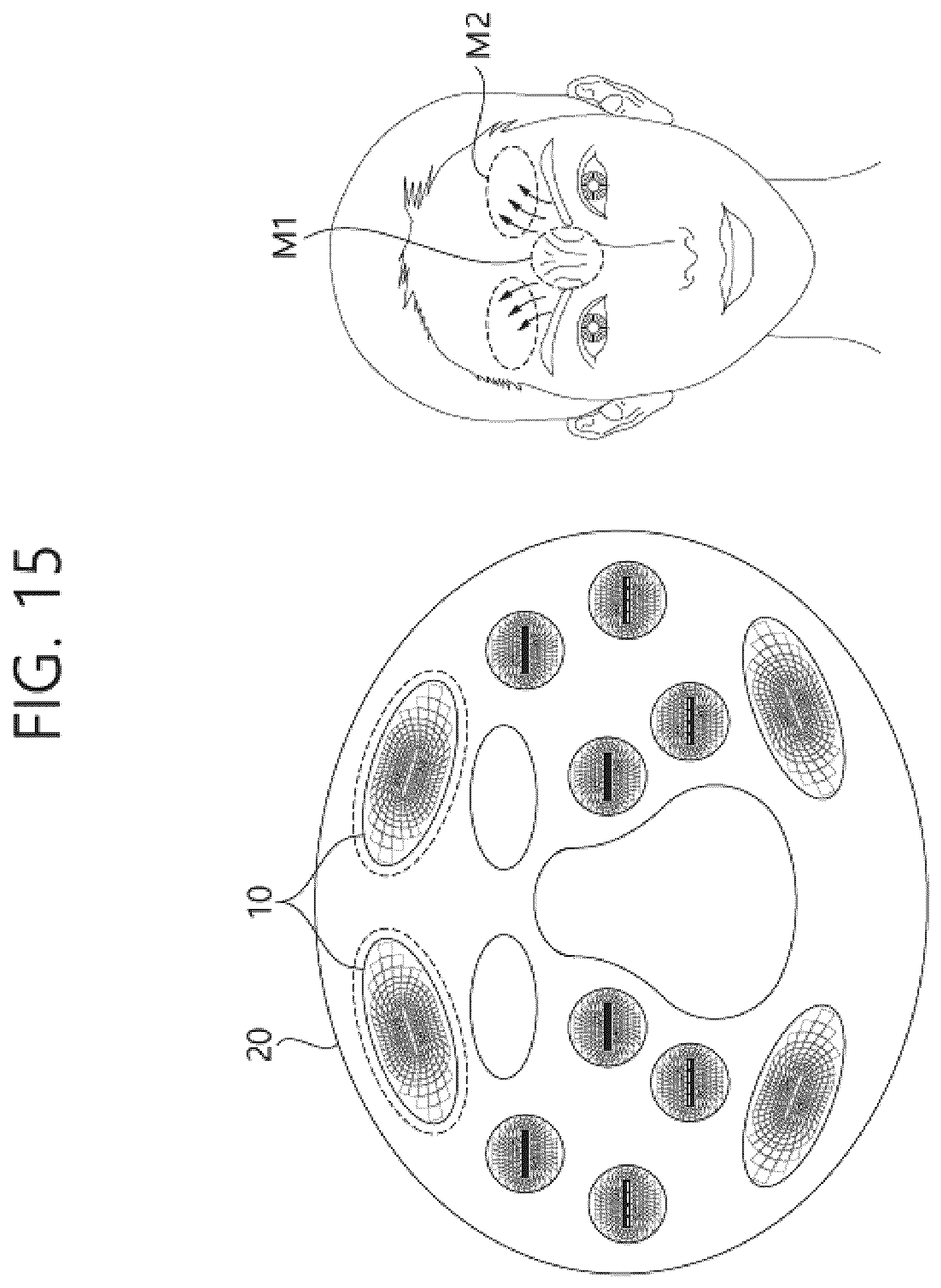 Patent US12102819 Figure 18 – Electrical muscle stimulation method using the electrical muscle simulation electrode pad