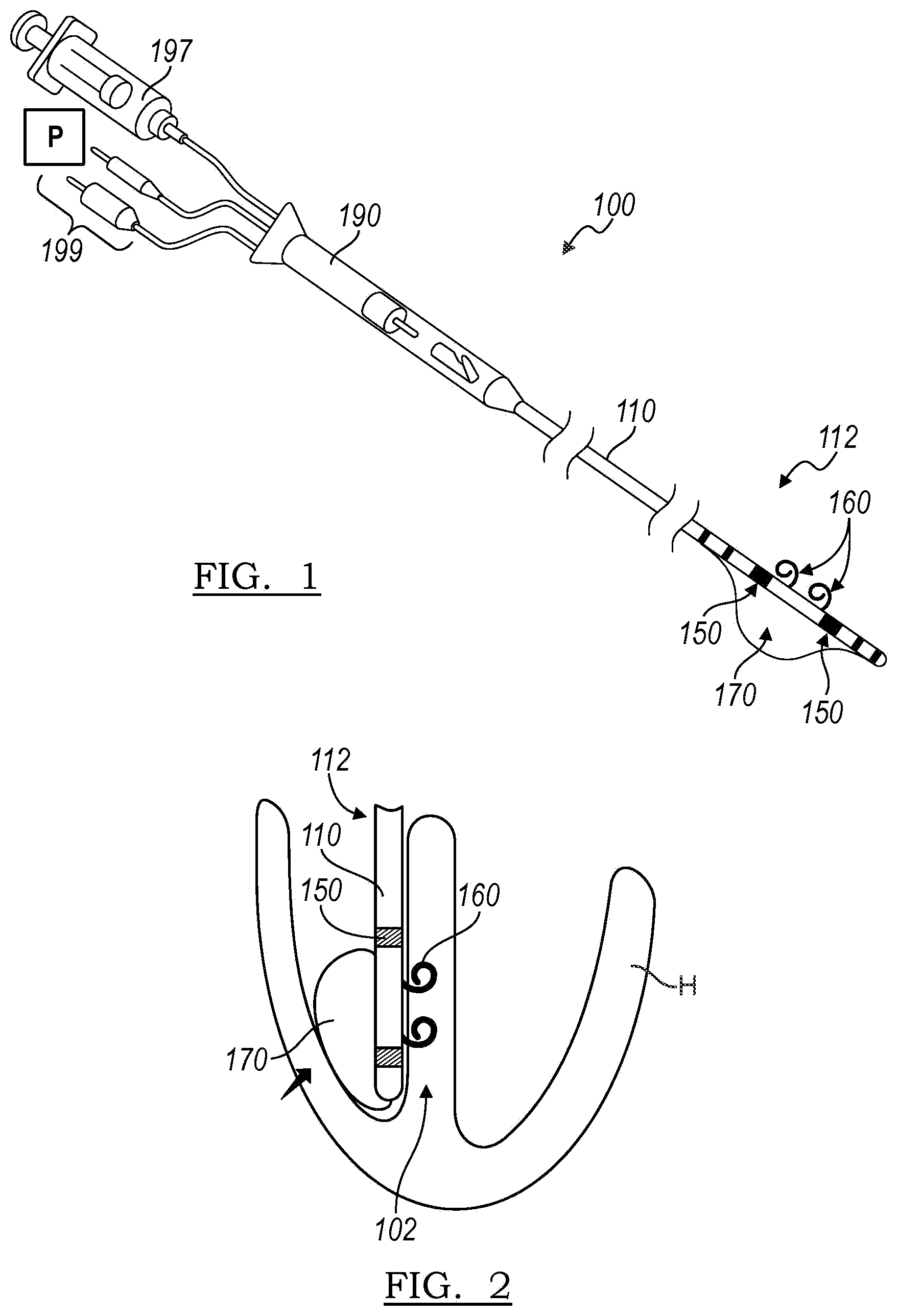 Patent US12102821 — Device and method for positioning an electrode in tissue — Figure 1