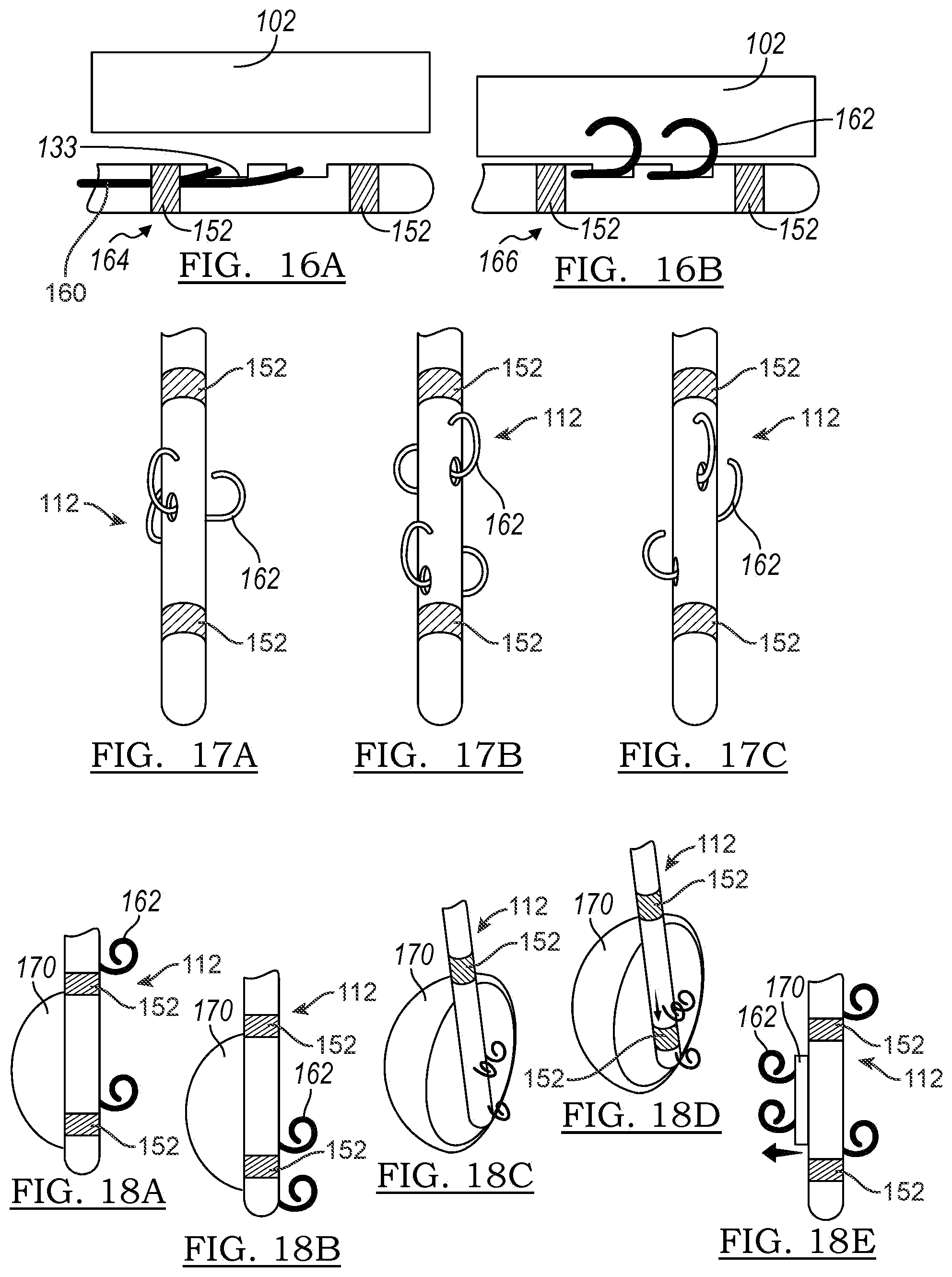 Patent US12102821 Figure 9 – Device and method for positioning an electrode in tissue