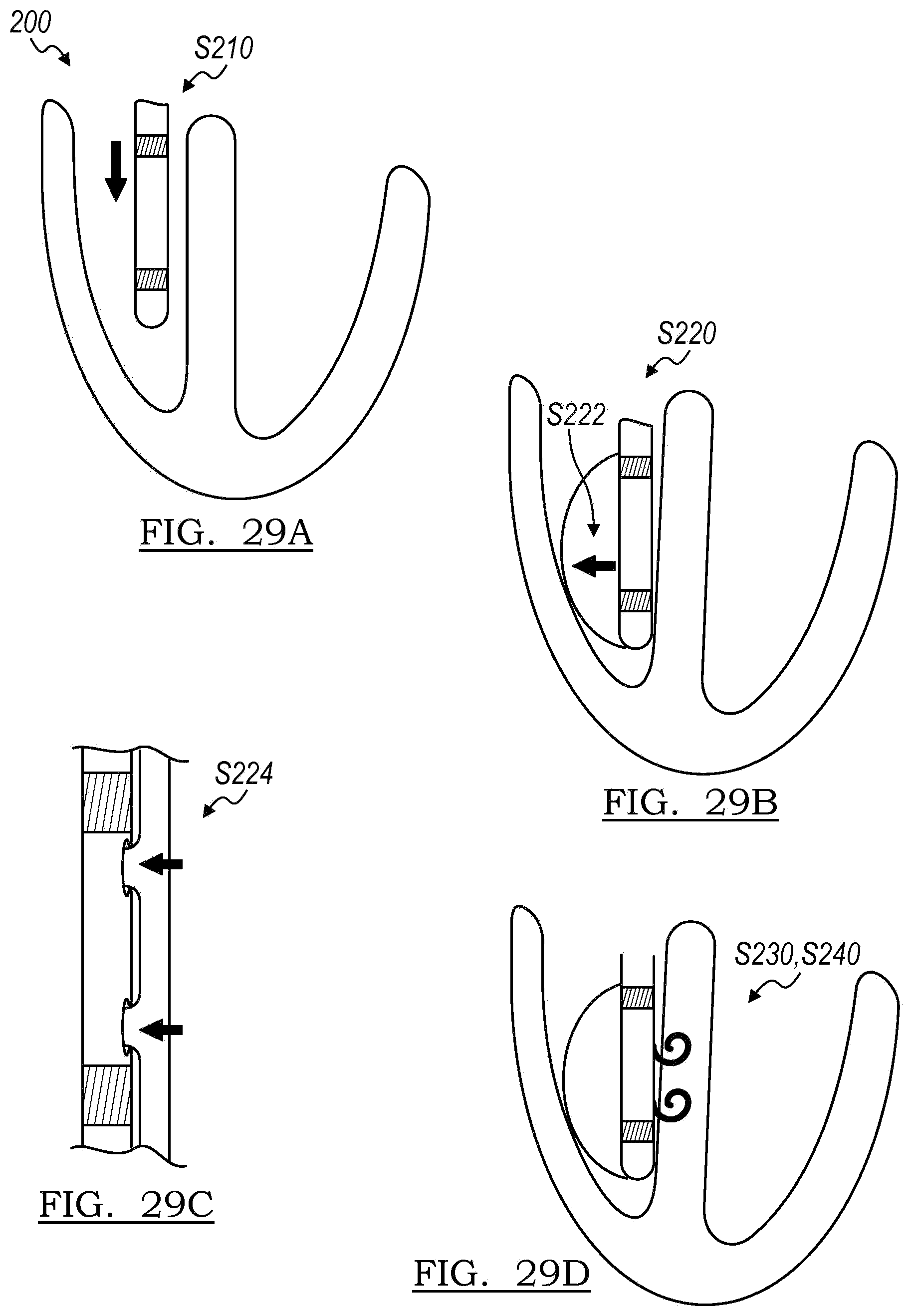 Patent US12102821 Figure 14 – Device and method for positioning an electrode in tissue