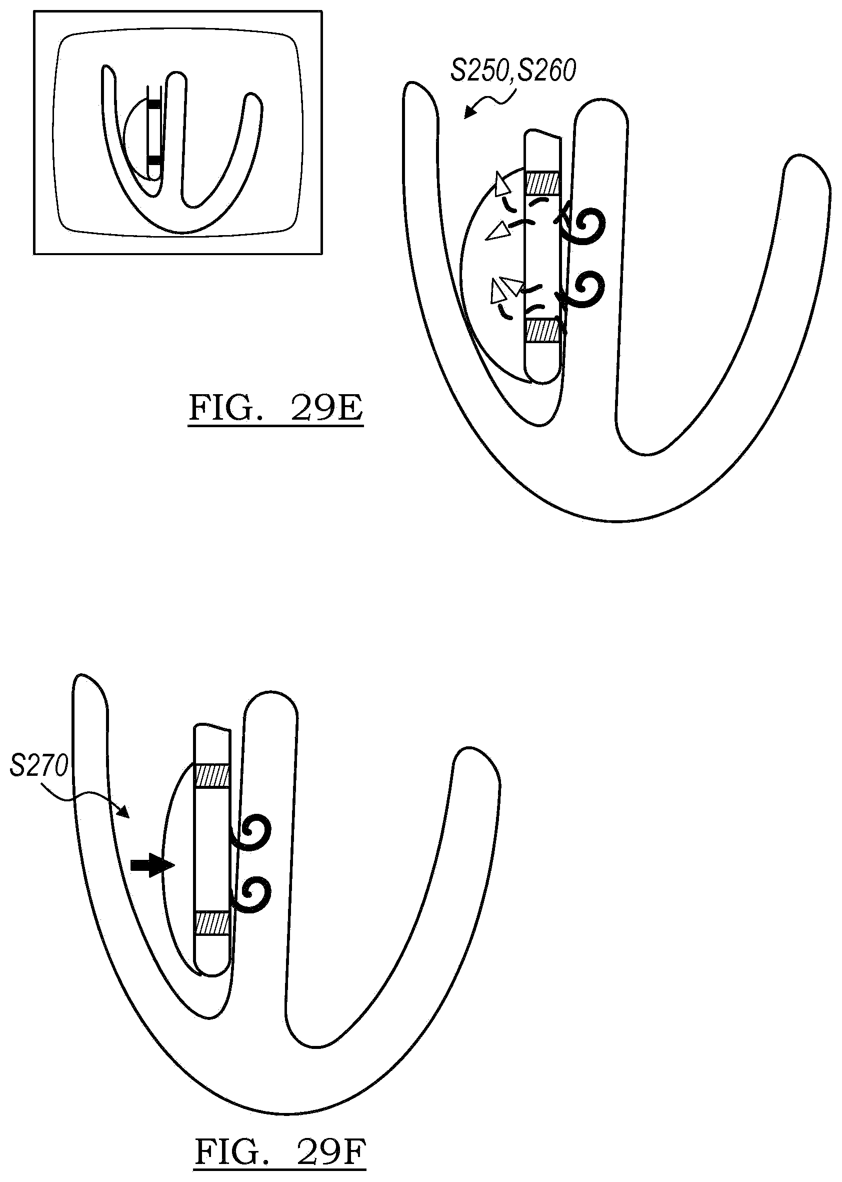 Patent US12102821 Figure 15 – Device and method for positioning an electrode in tissue