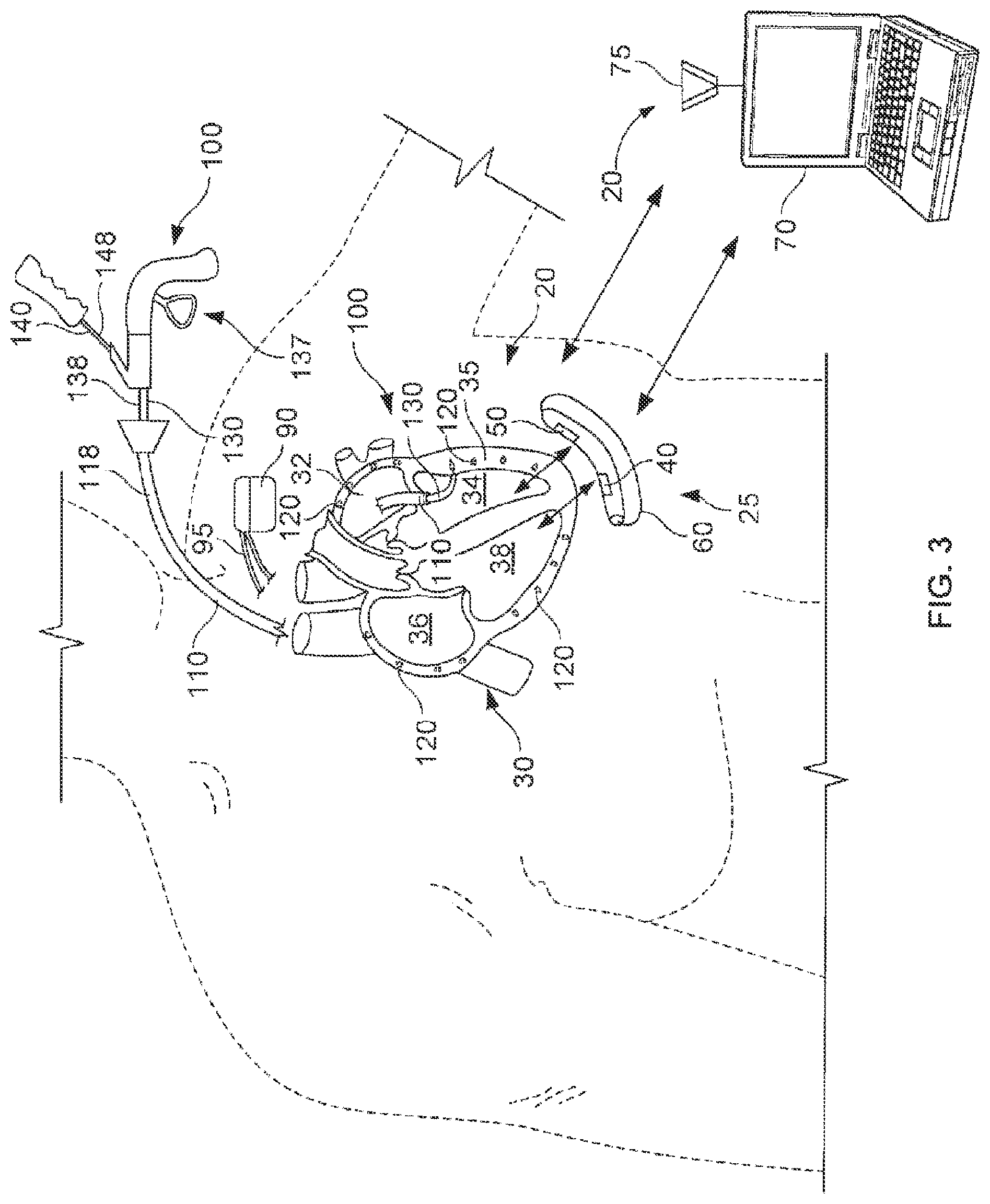 Patent US12102822 Figure 2 – Delivery of cardiac stimulation devices