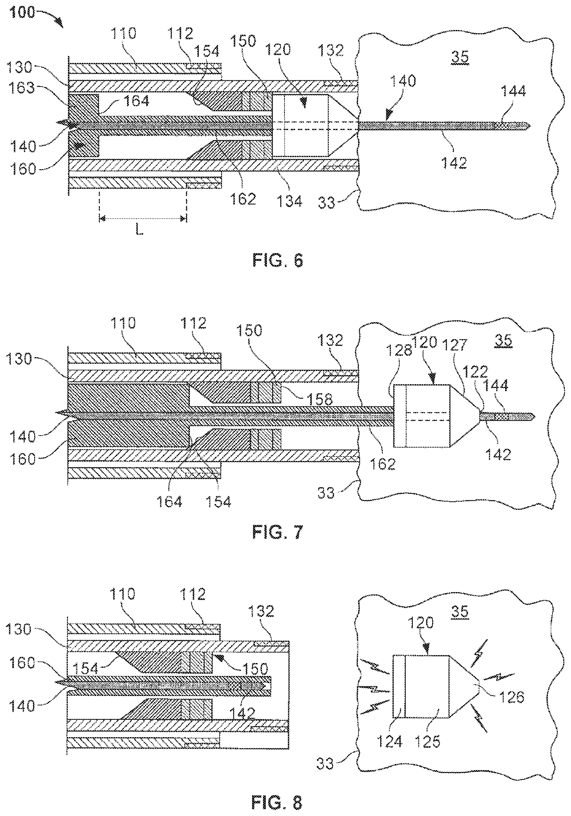 Patent US12102822 Figure 4 – Delivery of cardiac stimulation devices