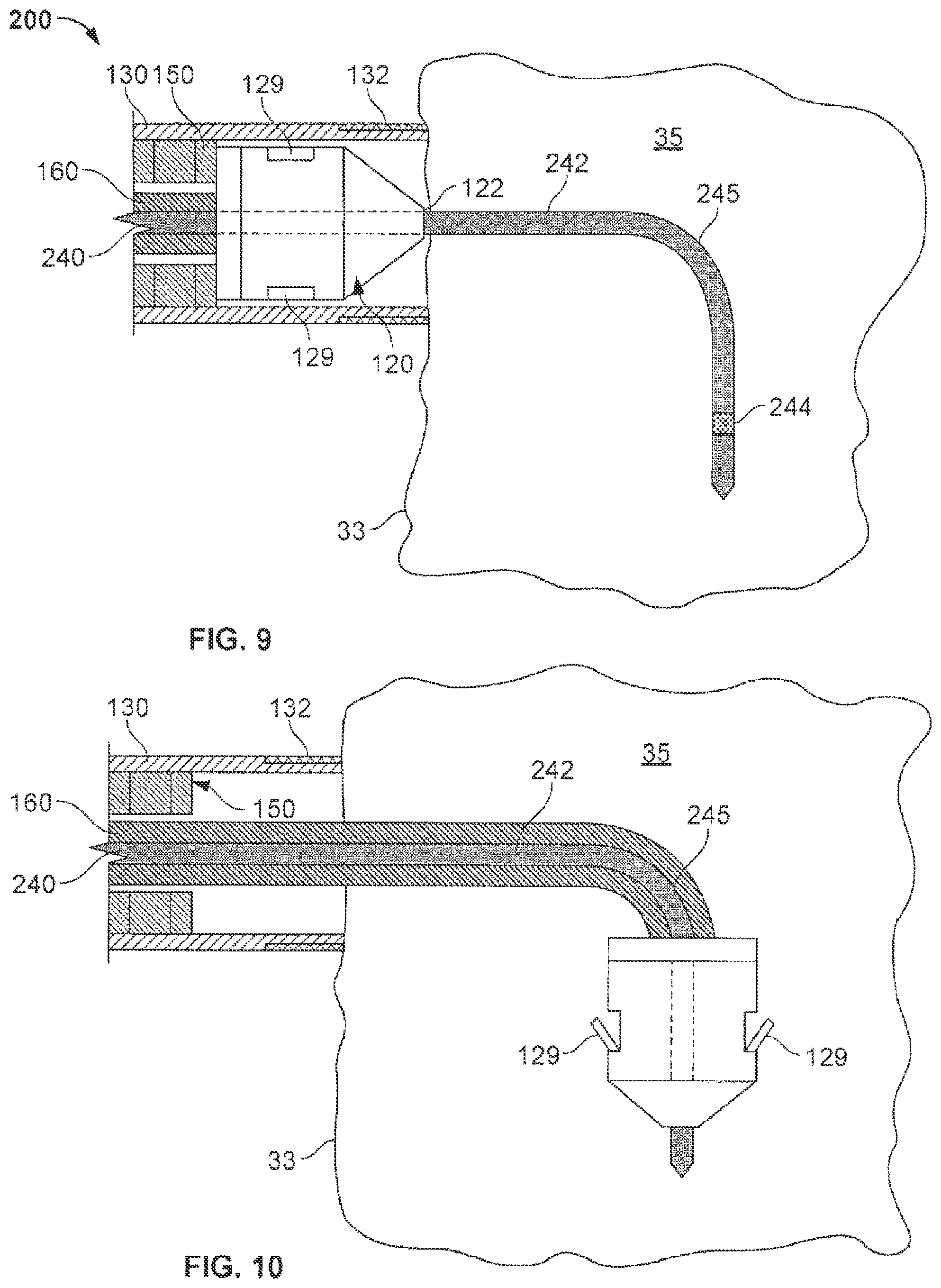 Patent US12102822 Figure 5 – Delivery of cardiac stimulation devices