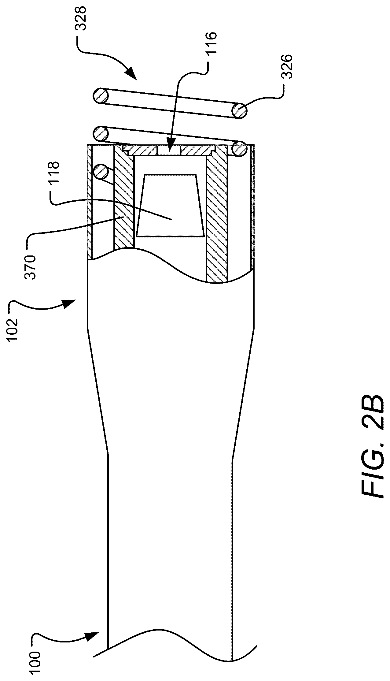 Patent US12102823 Figure 3 – Device, system, and method for delivery of an implantable cardiac lead and associated active agent delivery component