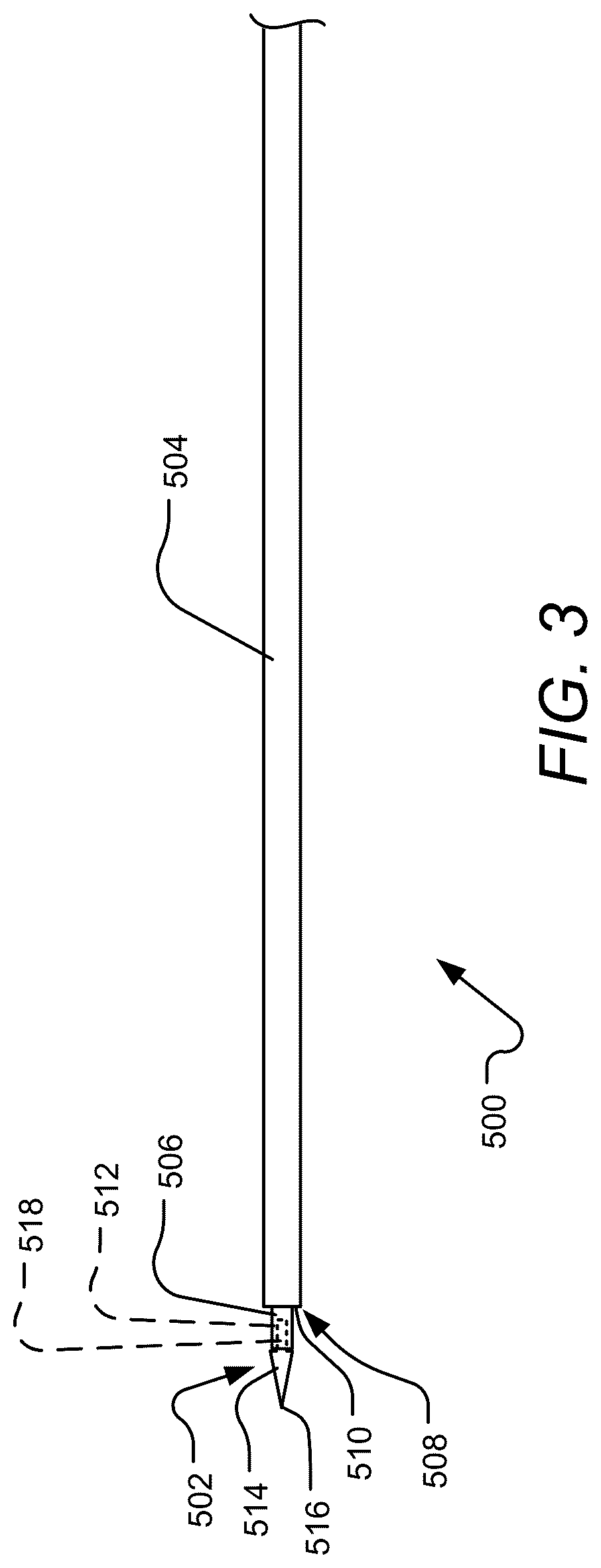 Patent US12102823 Figure 4 – Device, system, and method for delivery of an implantable cardiac lead and associated active agent delivery component