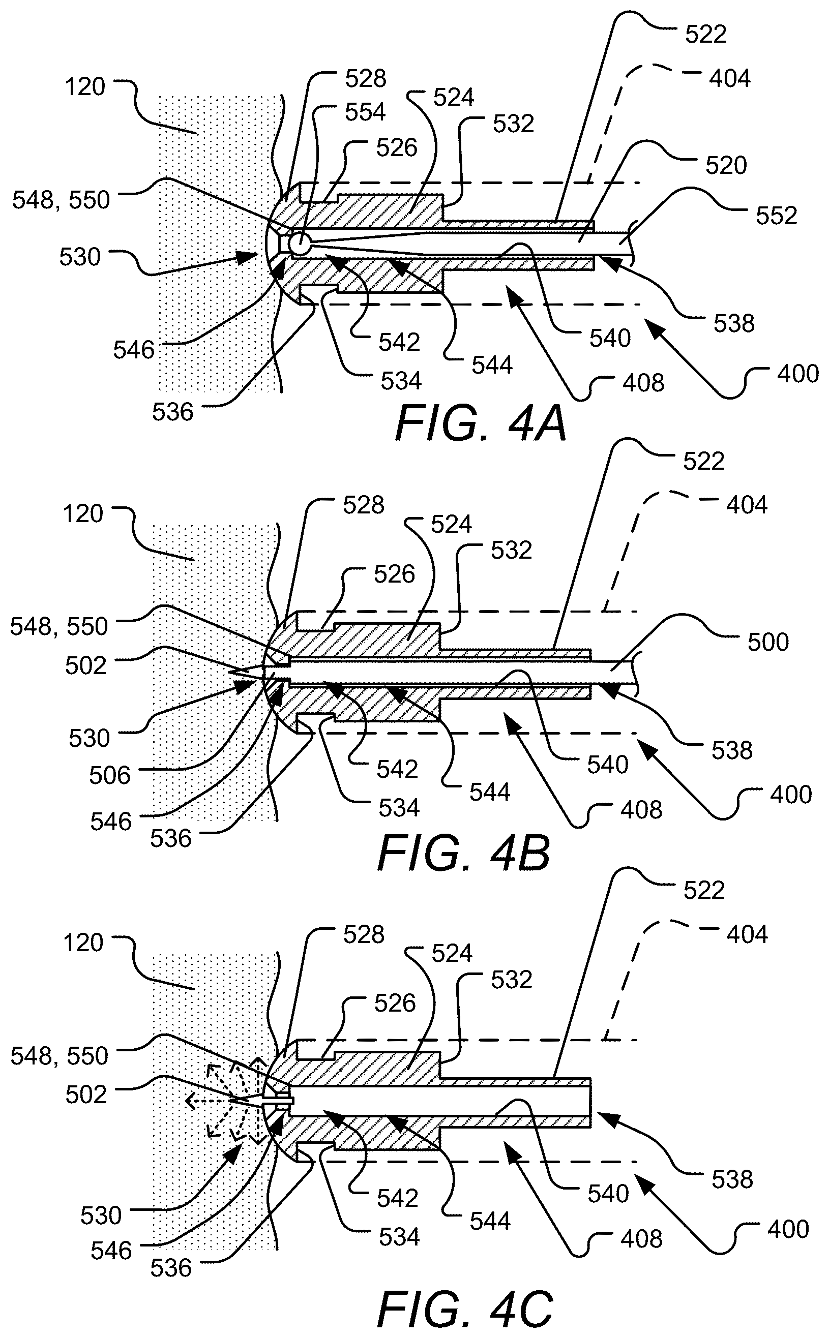 Patent US12102823 Figure 5 – Device, system, and method for delivery of an implantable cardiac lead and associated active agent delivery component