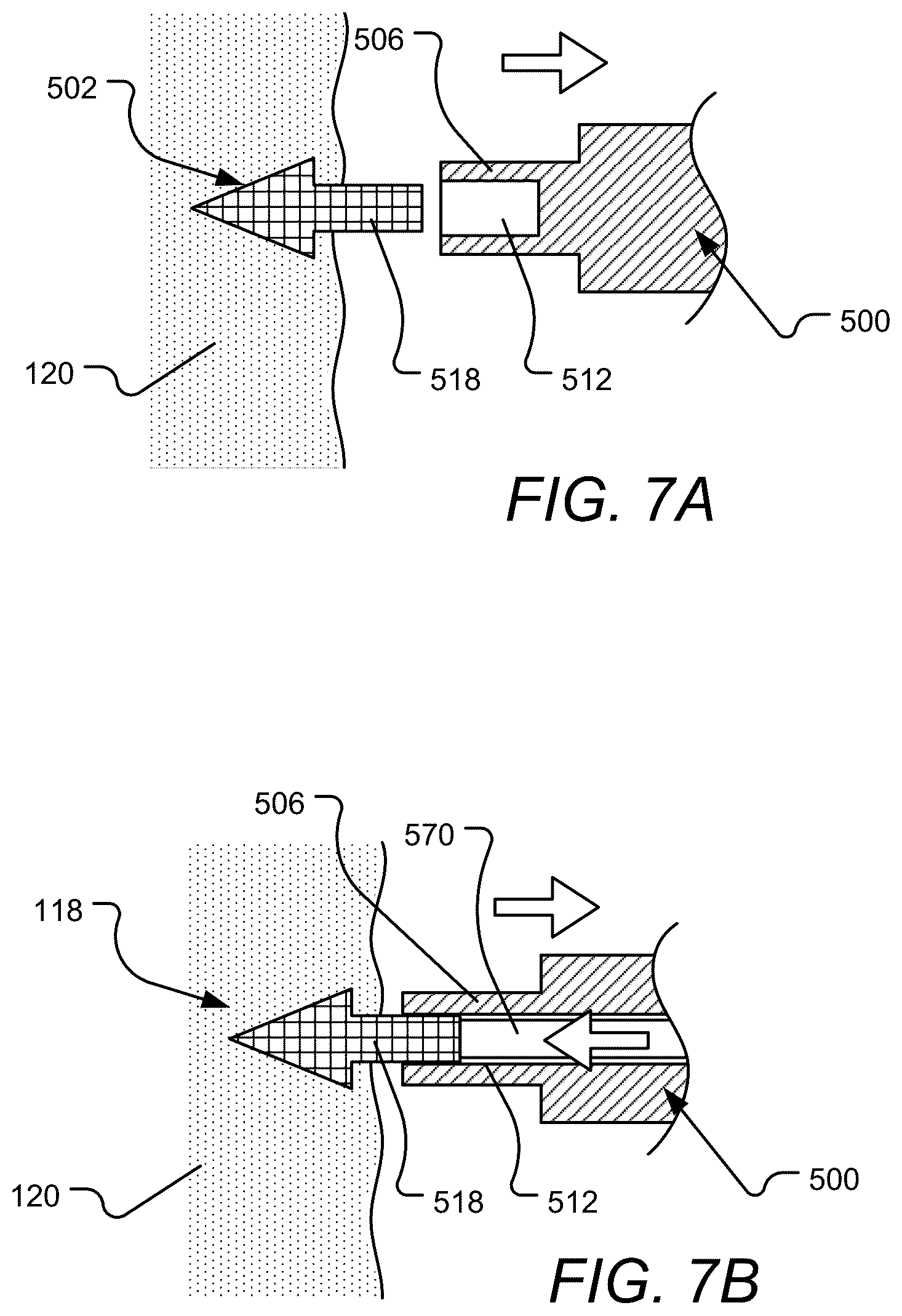 Patent US12102823 Figure 8 – Device, system, and method for delivery of an implantable cardiac lead and associated active agent delivery component