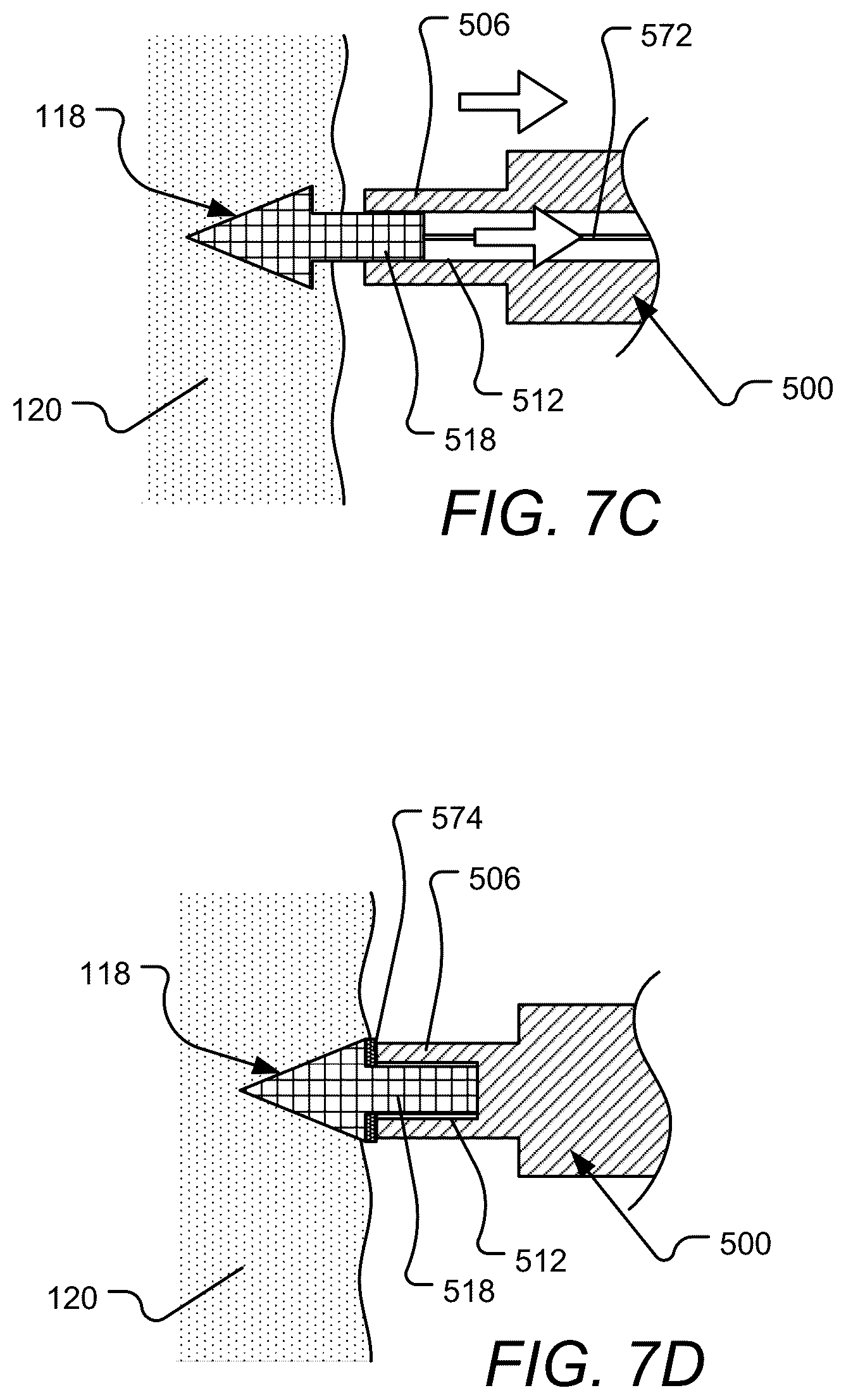 Patent US12102823 Figure 9 – Device, system, and method for delivery of an implantable cardiac lead and associated active agent delivery component