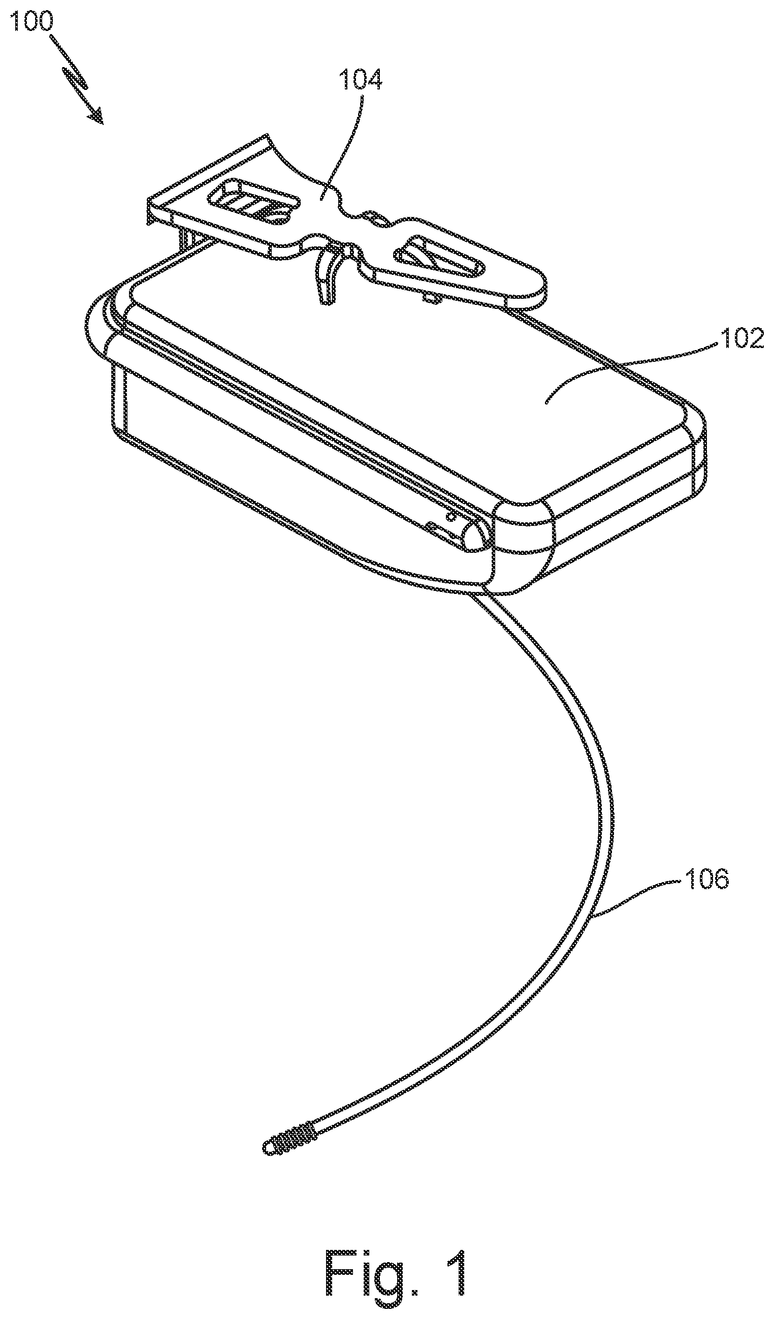 Patent US12102824 Figure 1 – Subcutaneous device for preventing and treating atherosclerosis