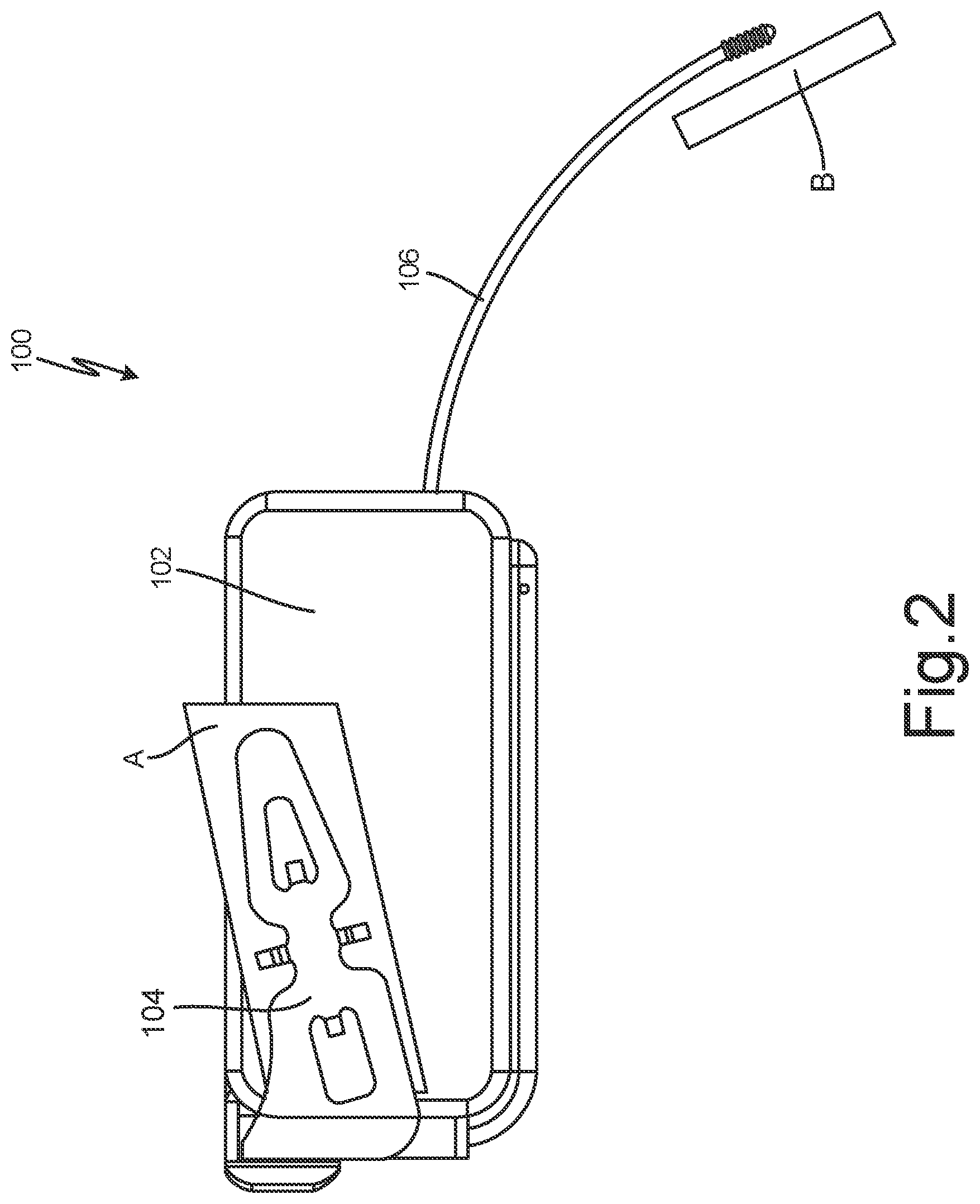 Patent US12102824 Figure 2 – Subcutaneous device for preventing and treating atherosclerosis