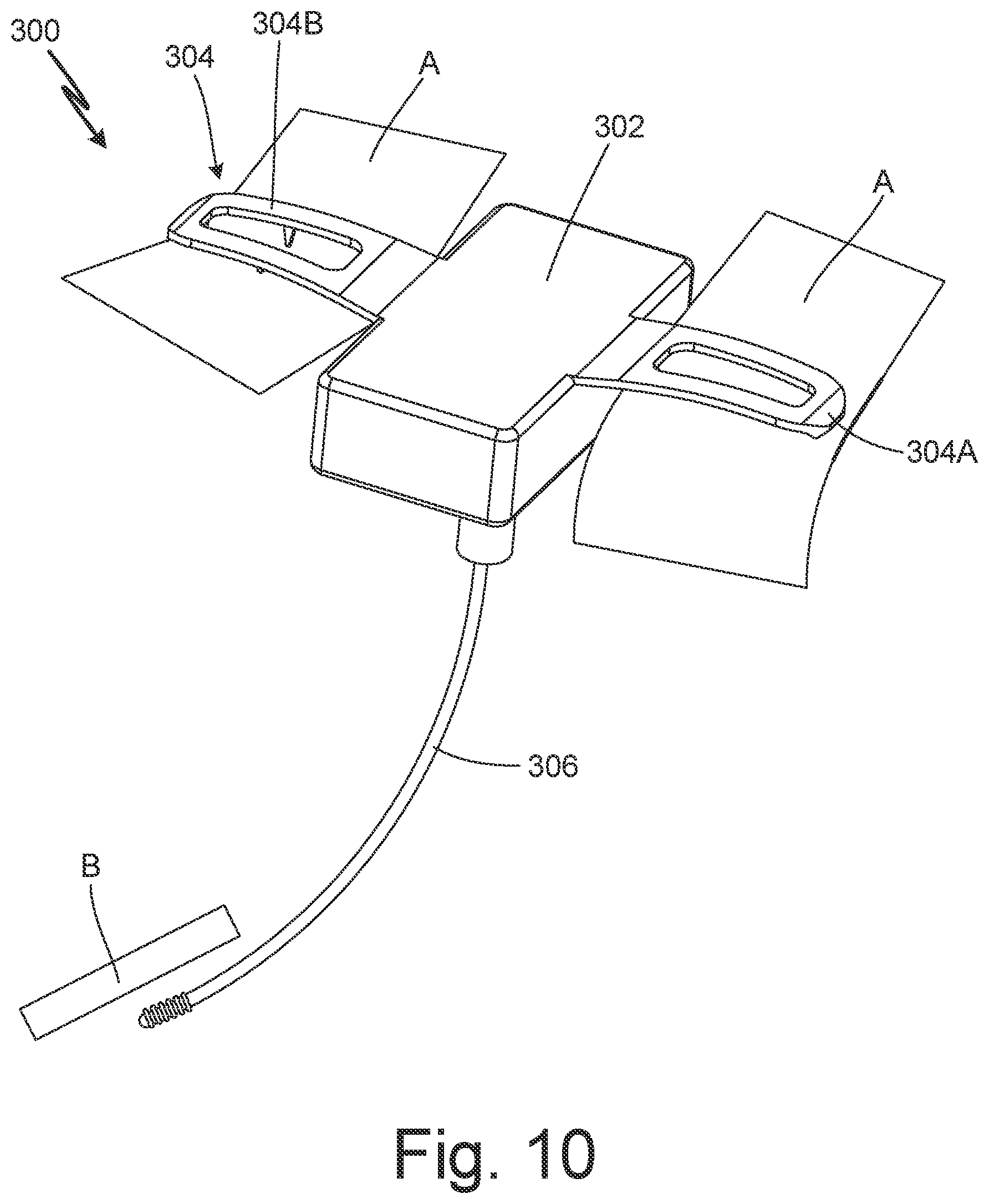 Patent US12102824 Figure 14 – Subcutaneous device for preventing and treating atherosclerosis