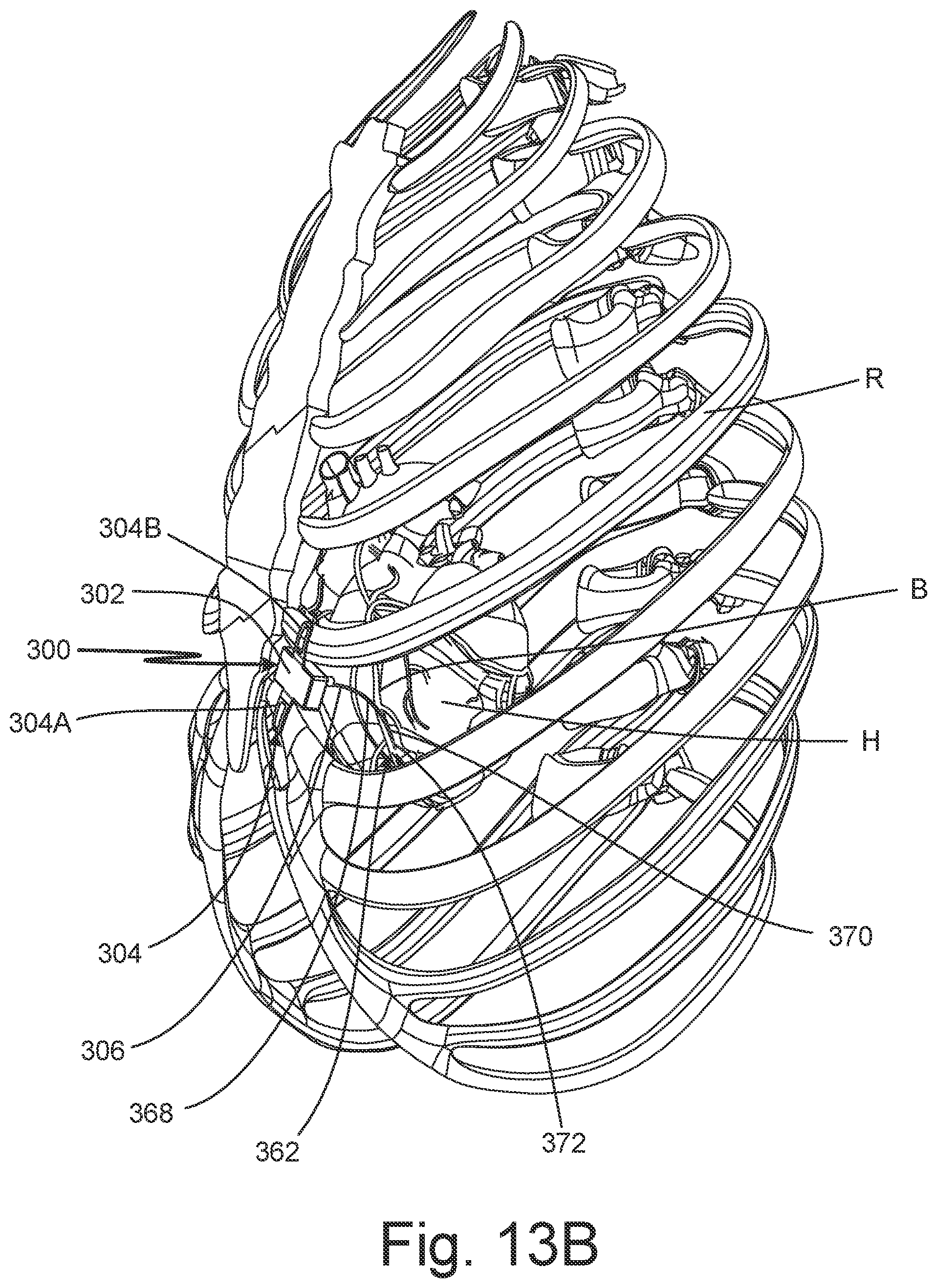 Patent US12102824 Figure 19 – Subcutaneous device for preventing and treating atherosclerosis
