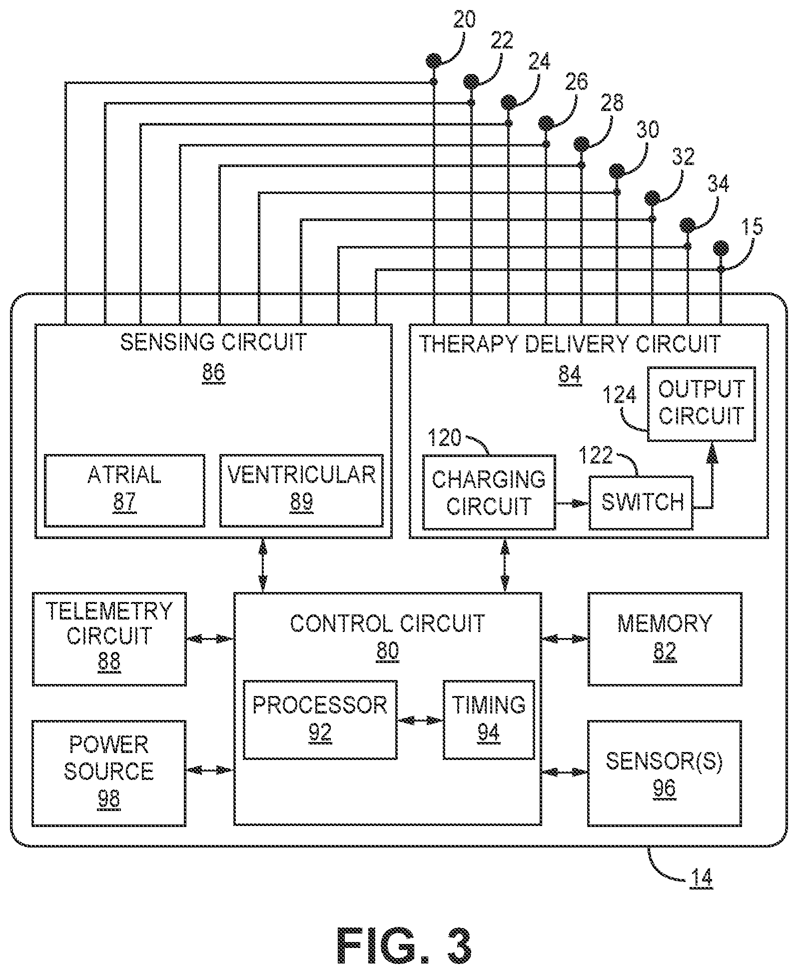 Patent US12102828 Figure 3 – T-wave morphology analysis for pathological event detection