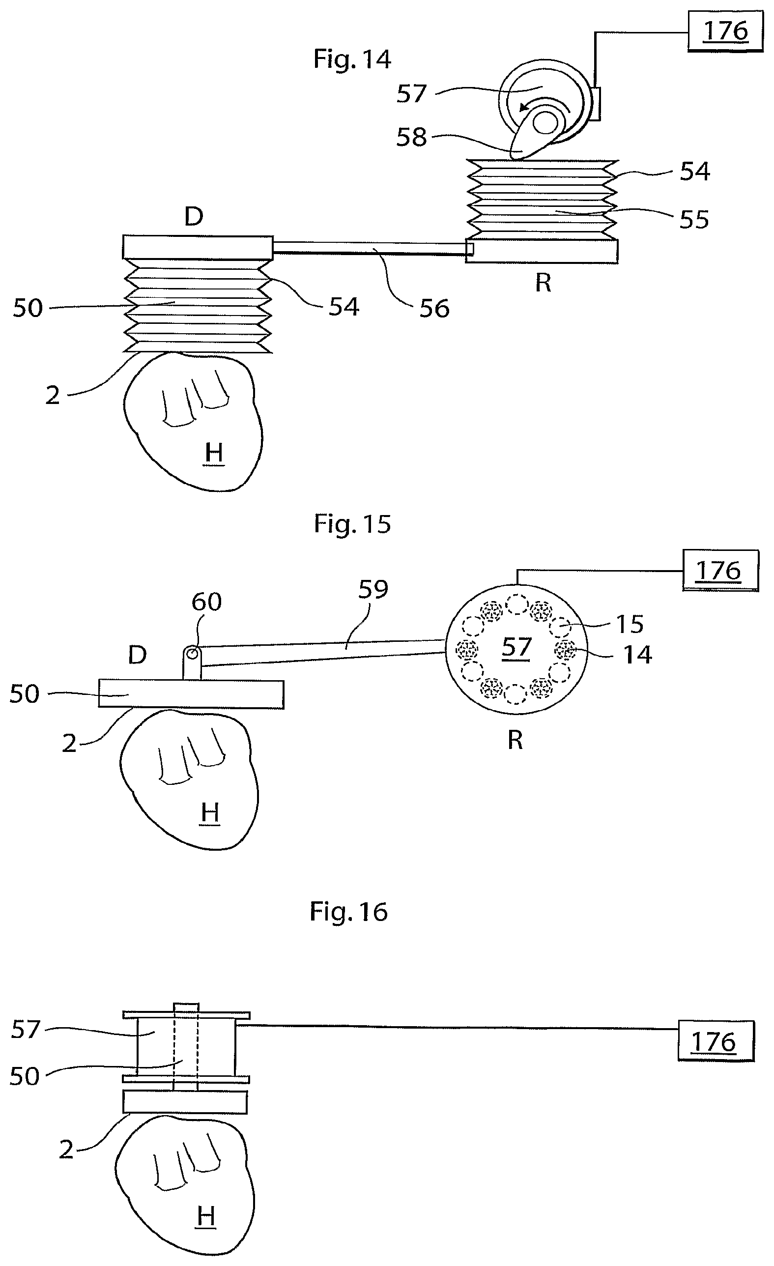 Patent US12102829 Figure 7 – Heart help device, method and system