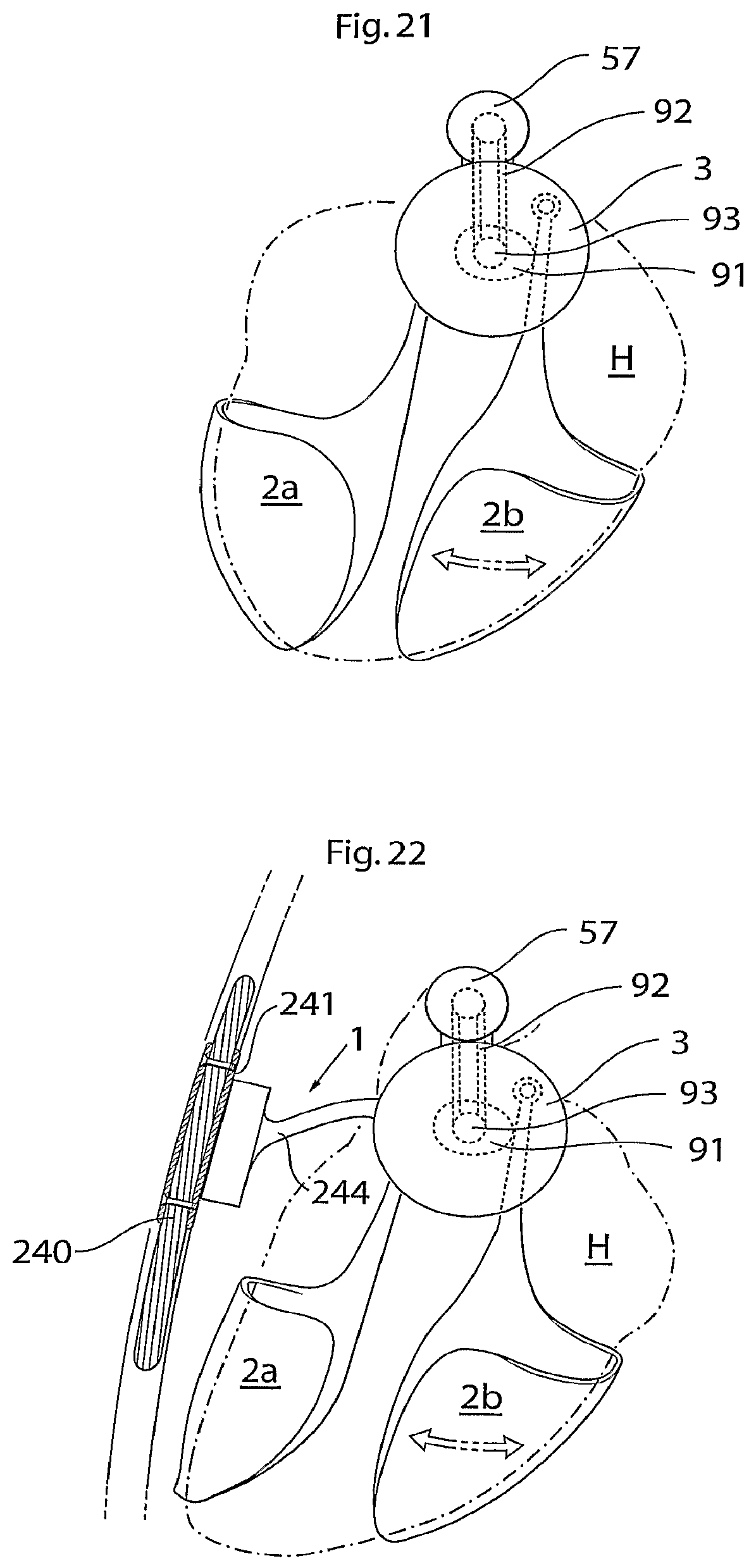 Patent US12102829 Figure 9 – Heart help device, method and system