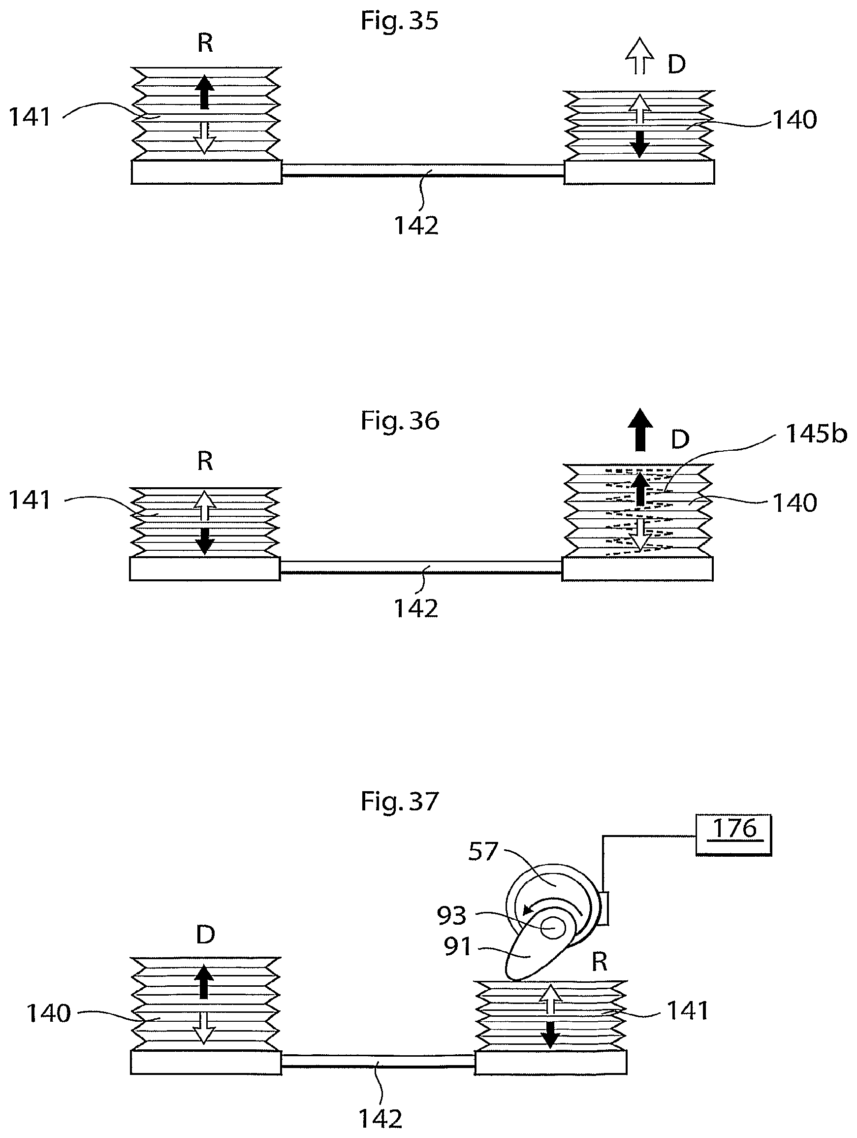 Patent US12102829 Figure 14 – Heart help device, method and system