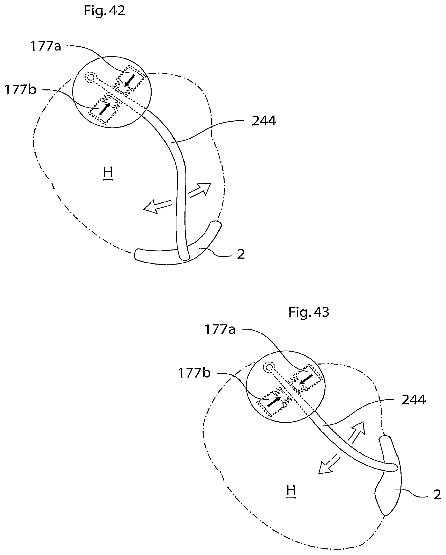 Patent US12102829 Figure 17 – Heart help device, method and system