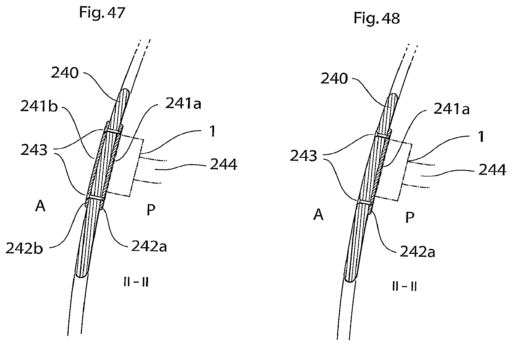 Patent US12102829 Figure 20 – Heart help device, method and system