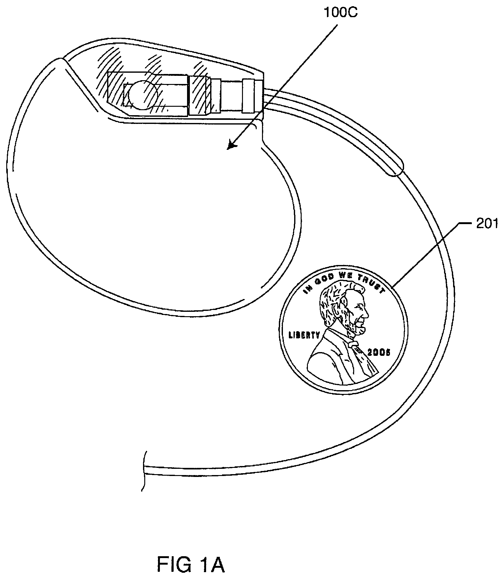 Patent US12102831 Figure 2 – Clinical static strip magnet of alternating polarities to prevent inadvertent actuation of magnet-mode in an active implantable medical device
