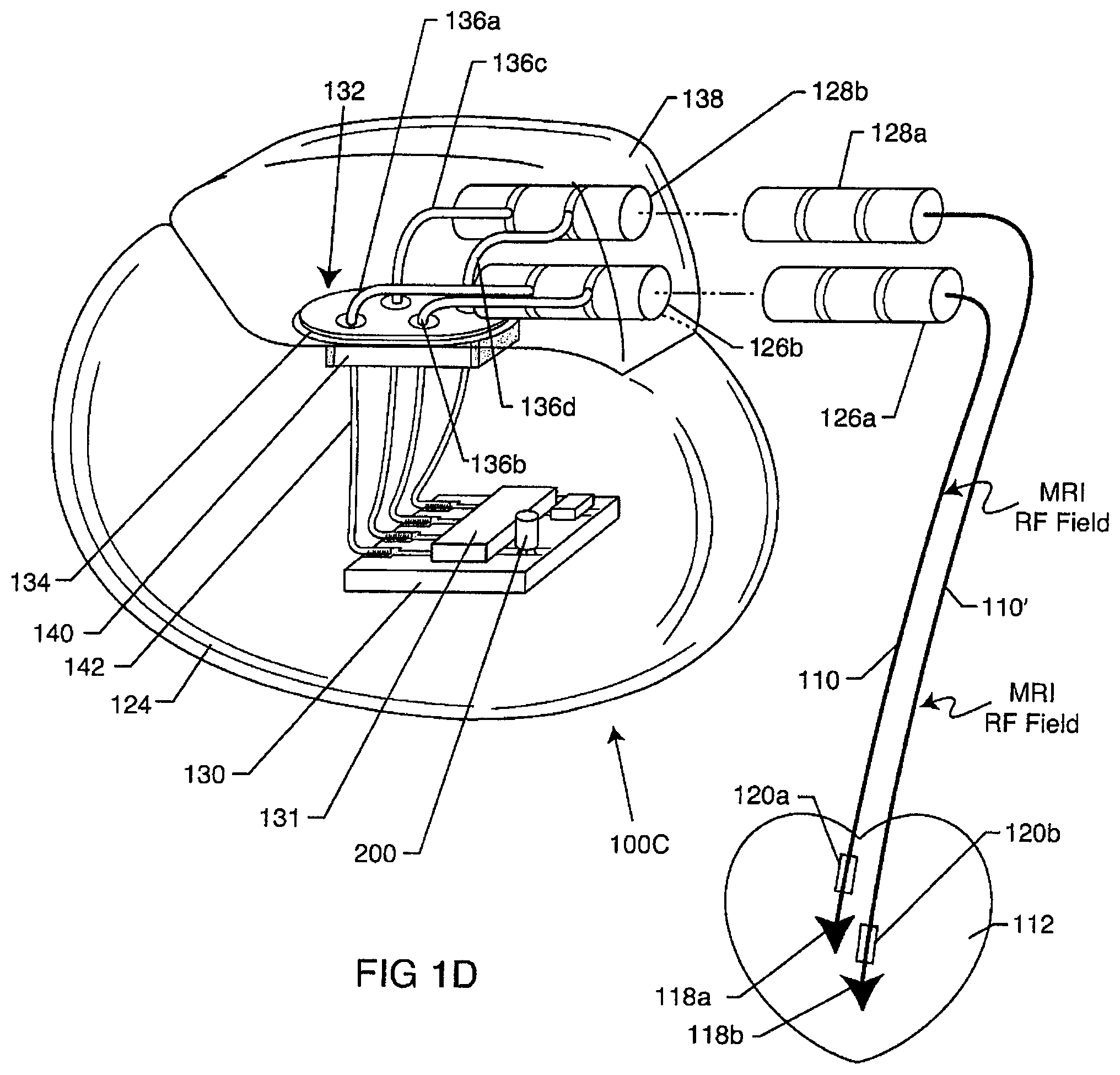 Patent US12102831 Figure 5 – Clinical static strip magnet of alternating polarities to prevent inadvertent actuation of magnet-mode in an active implantable medical device