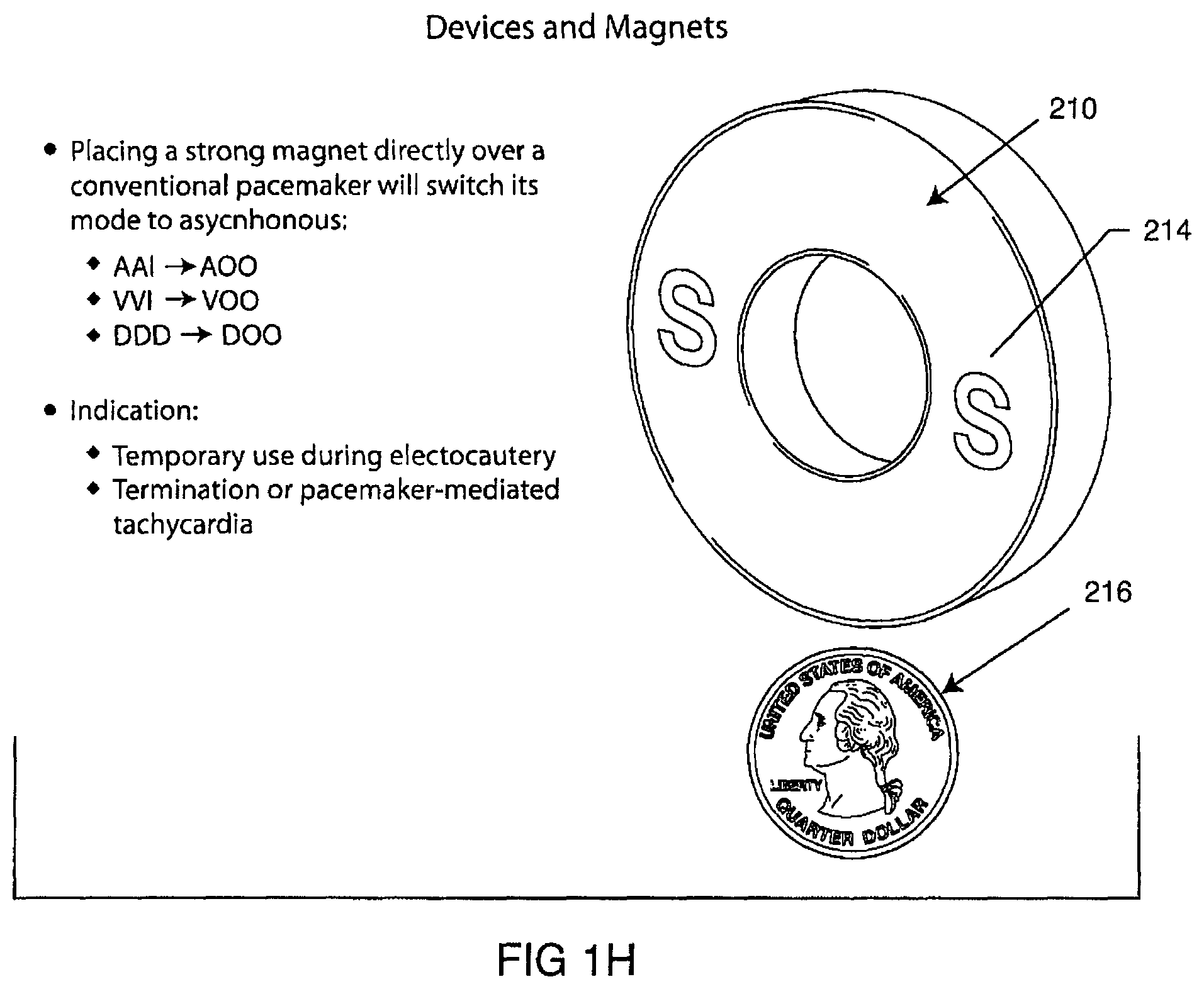 Patent US12102831 Figure 9 – Clinical static strip magnet of alternating polarities to prevent inadvertent actuation of magnet-mode in an active implantable medical device