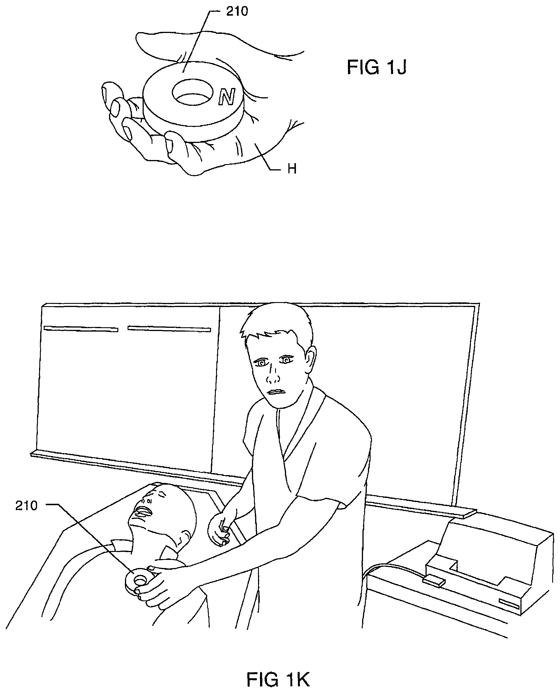 Patent US12102831 Figure 11 – Clinical static strip magnet of alternating polarities to prevent inadvertent actuation of magnet-mode in an active implantable medical device