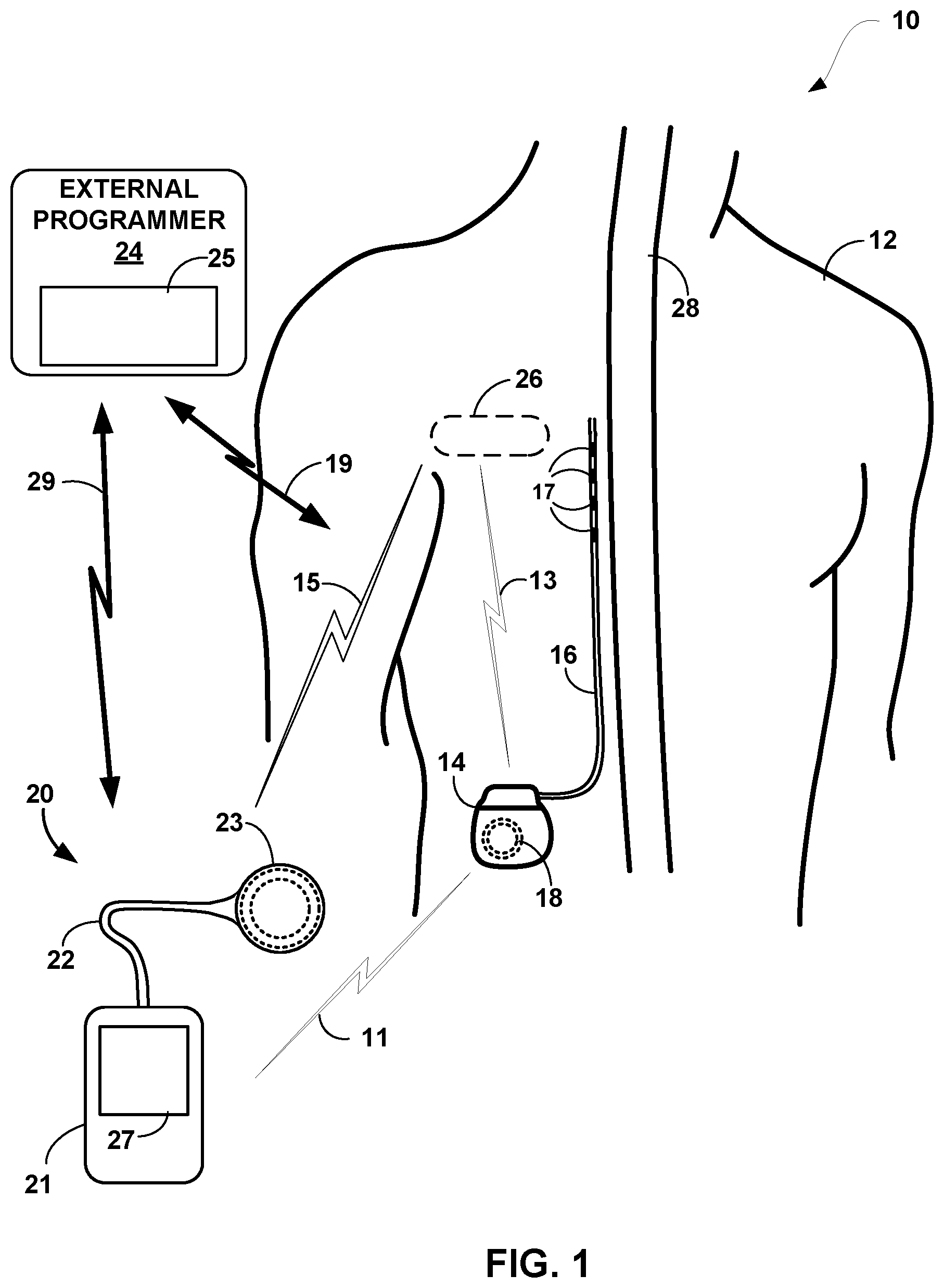 Patent US12102833 — Medical device recharging based on patient activity — Figure 1