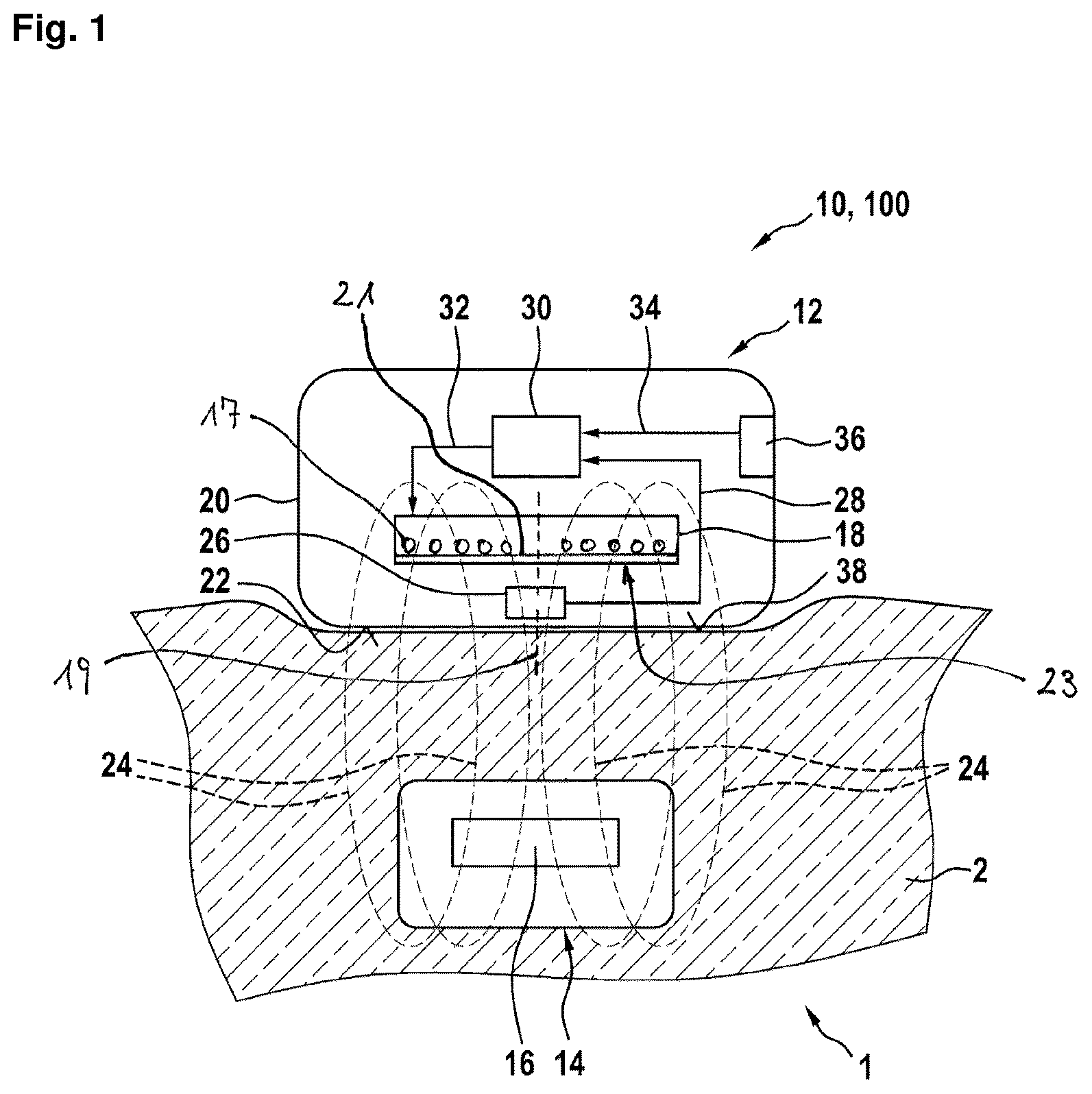Patent US12102835 Figure 1 – Transmission unit comprising a transmission coil and a temperature sensor
