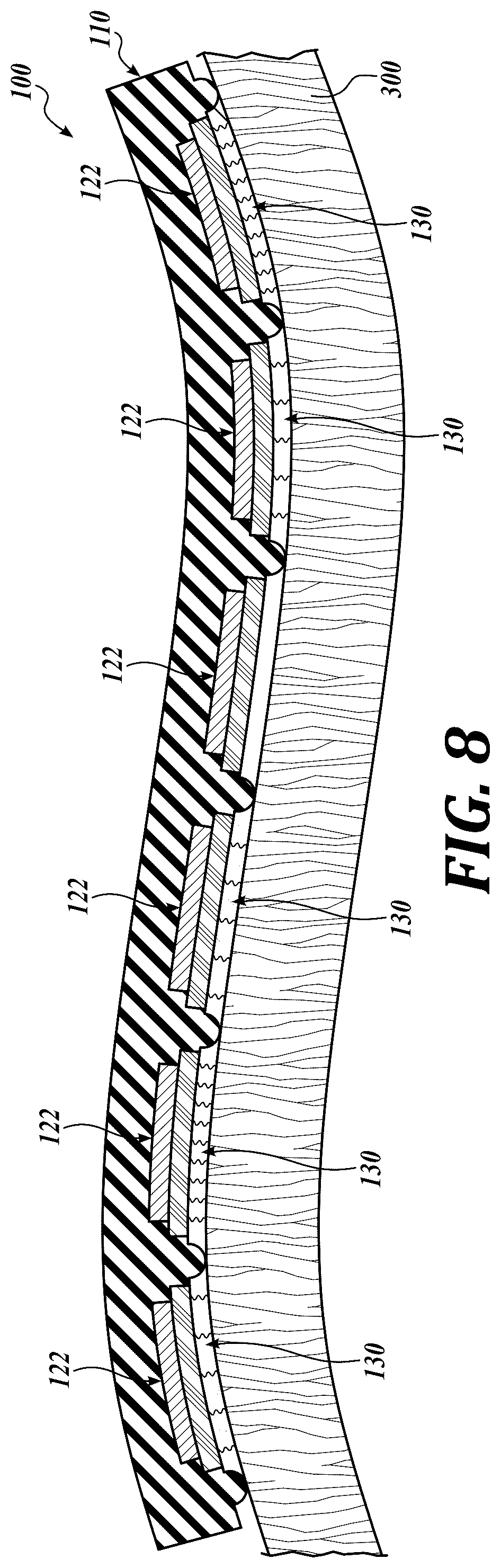 Patent US12102836 Figure 9 – Cold plasma generating array
