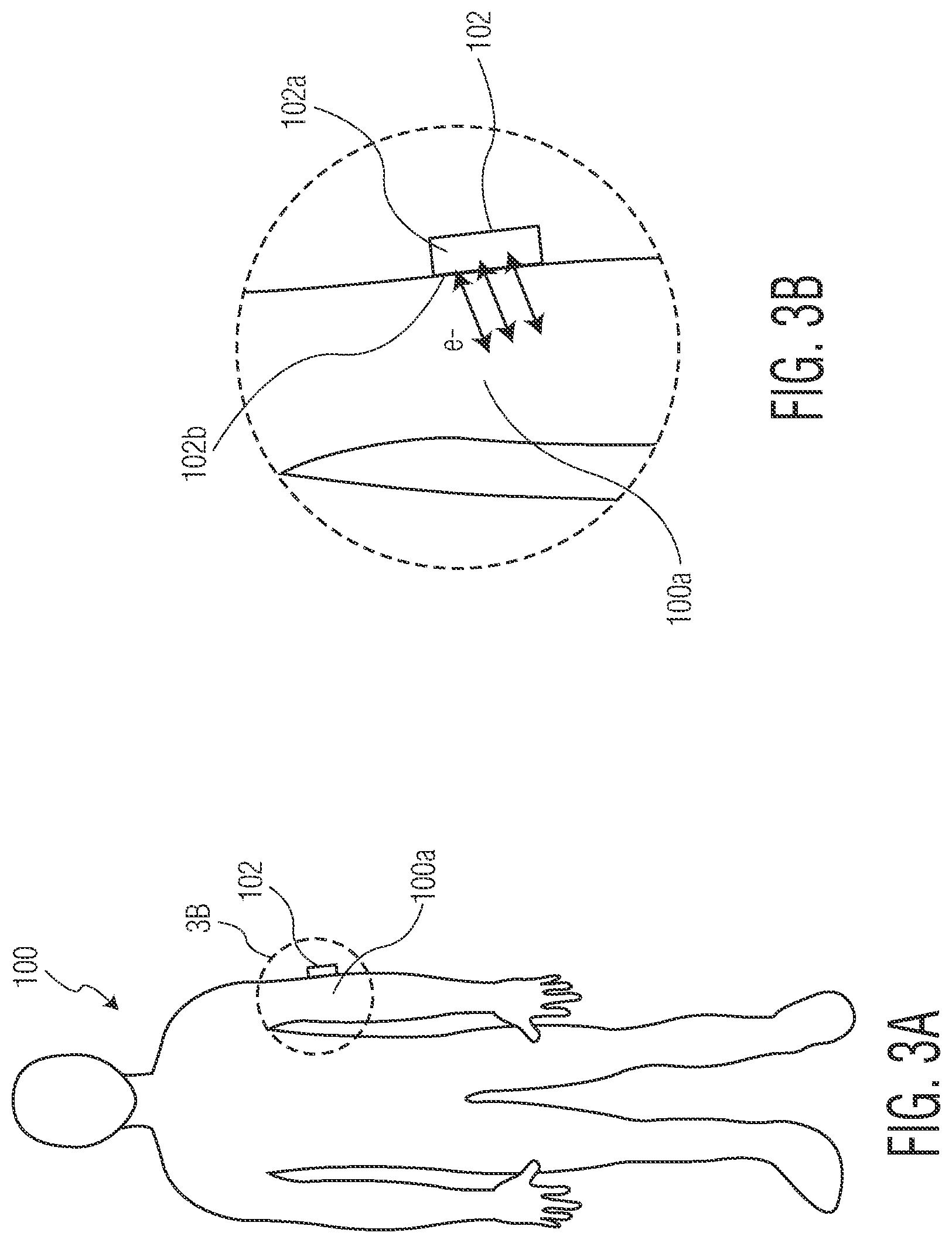 Patent US12102837 Figure 5 – Therapeutic bioelectromagnetic fields, pain relief devices, and related methods
