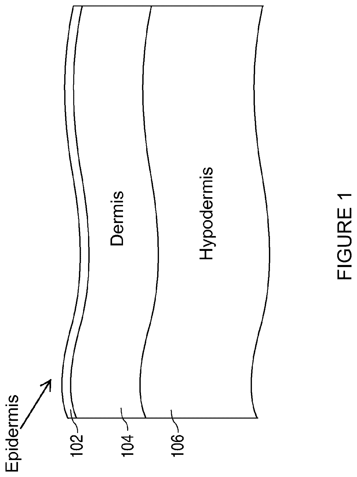 Patent US12102840 Figure 1 – Dermatological laser treatment systems and methods using optical parametric oscillator