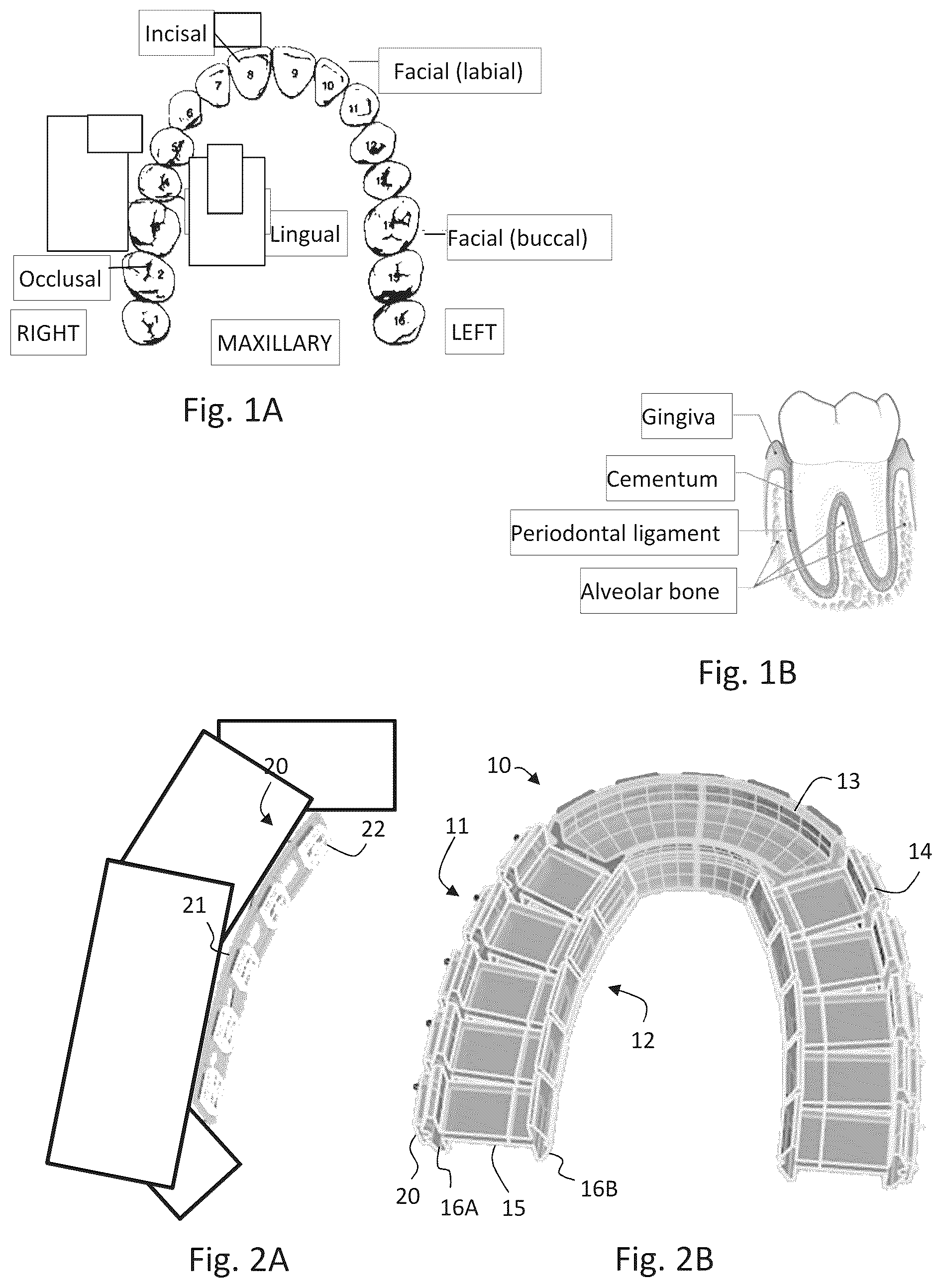 Patent US12102841 Figure 1 – Mouthpiece and method for intraoral treatment